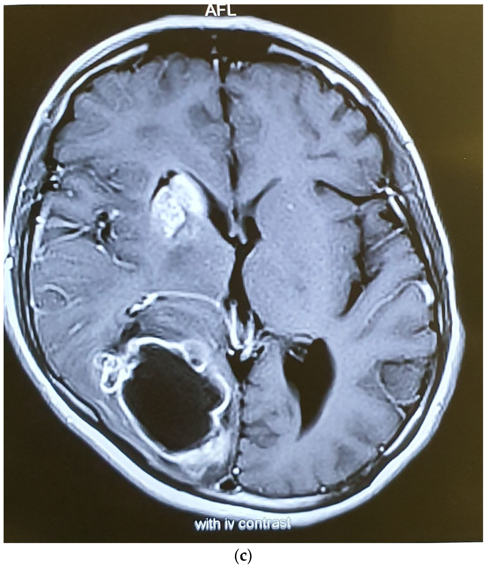 Brainsci 12 00958 g006b
