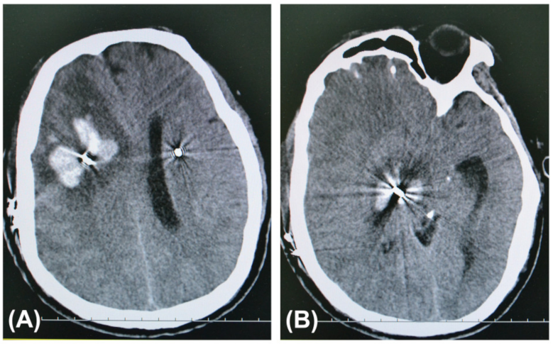 Brainsci 12 00967 g001