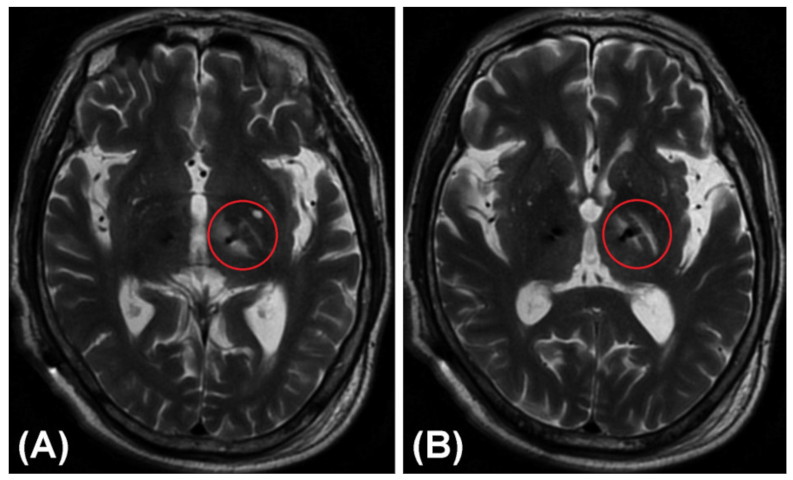 Brainsci 12 00967 g005