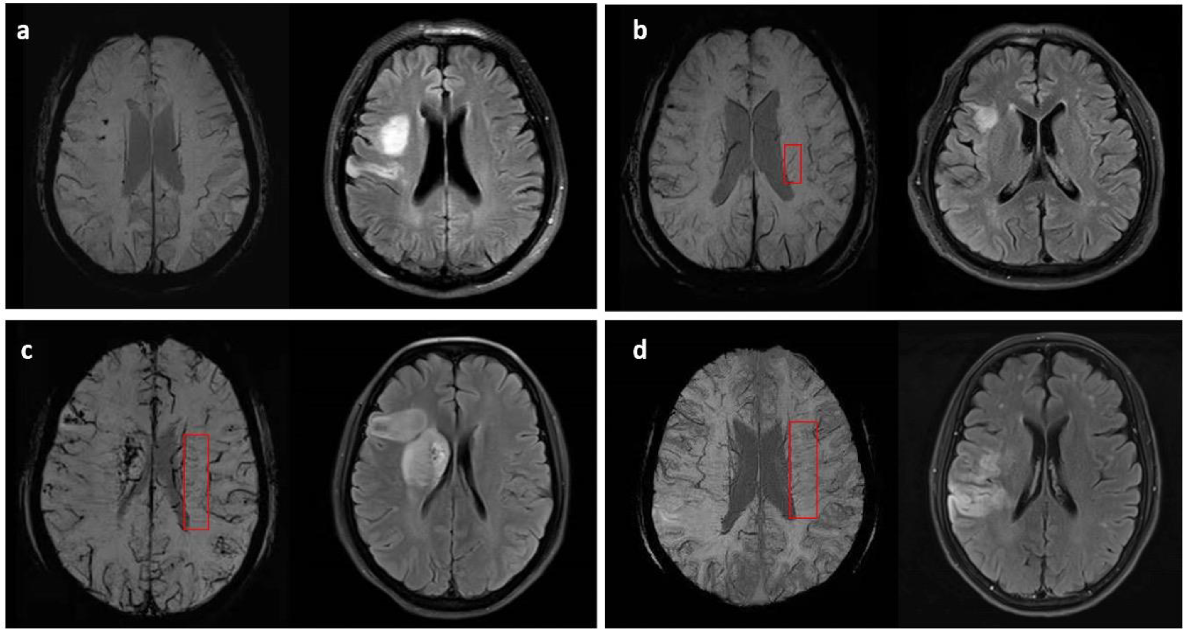 Brainsci 12 00978 g001 Brainsci 12 00978 g001