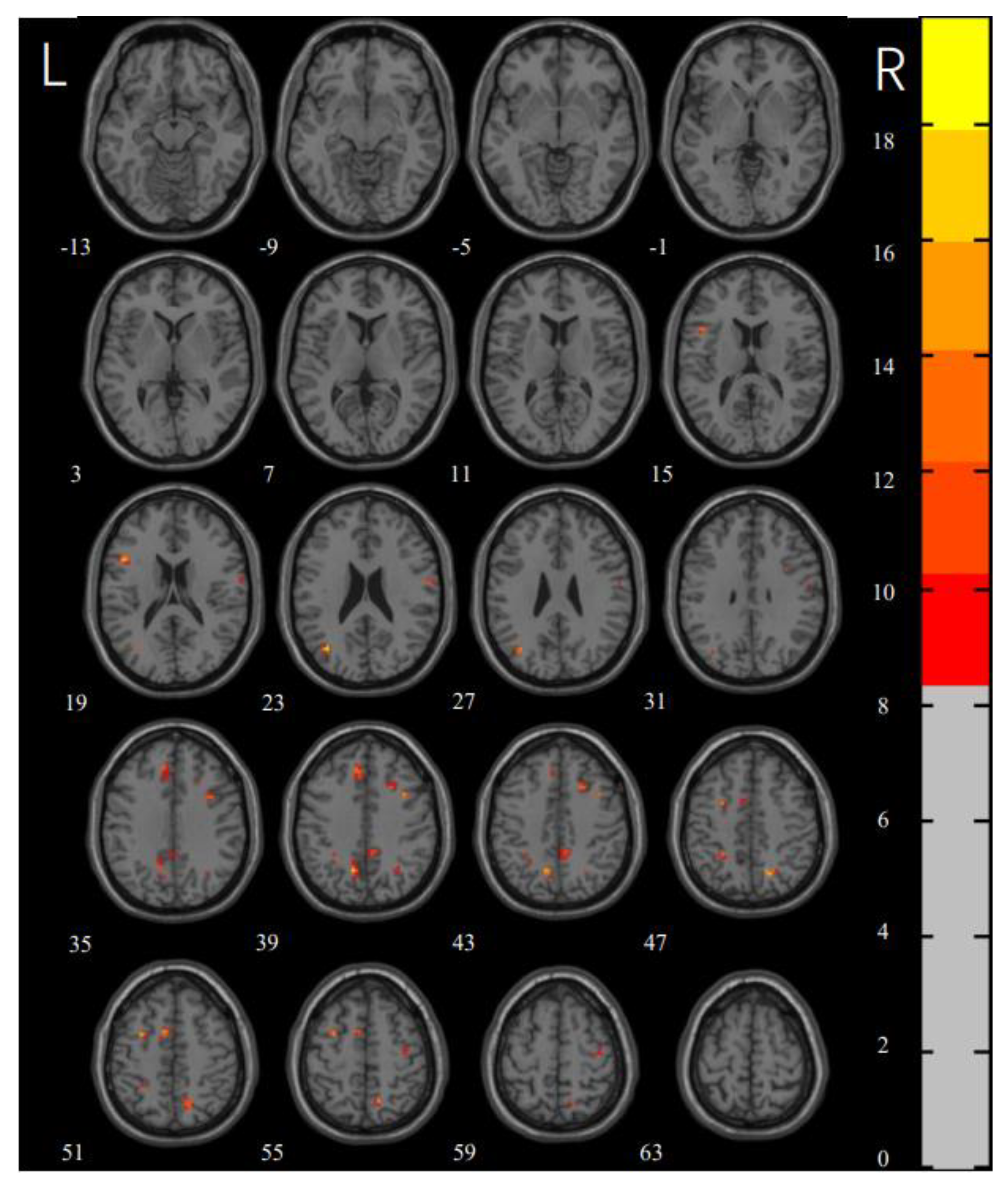 Brainsci 12 00998 g001