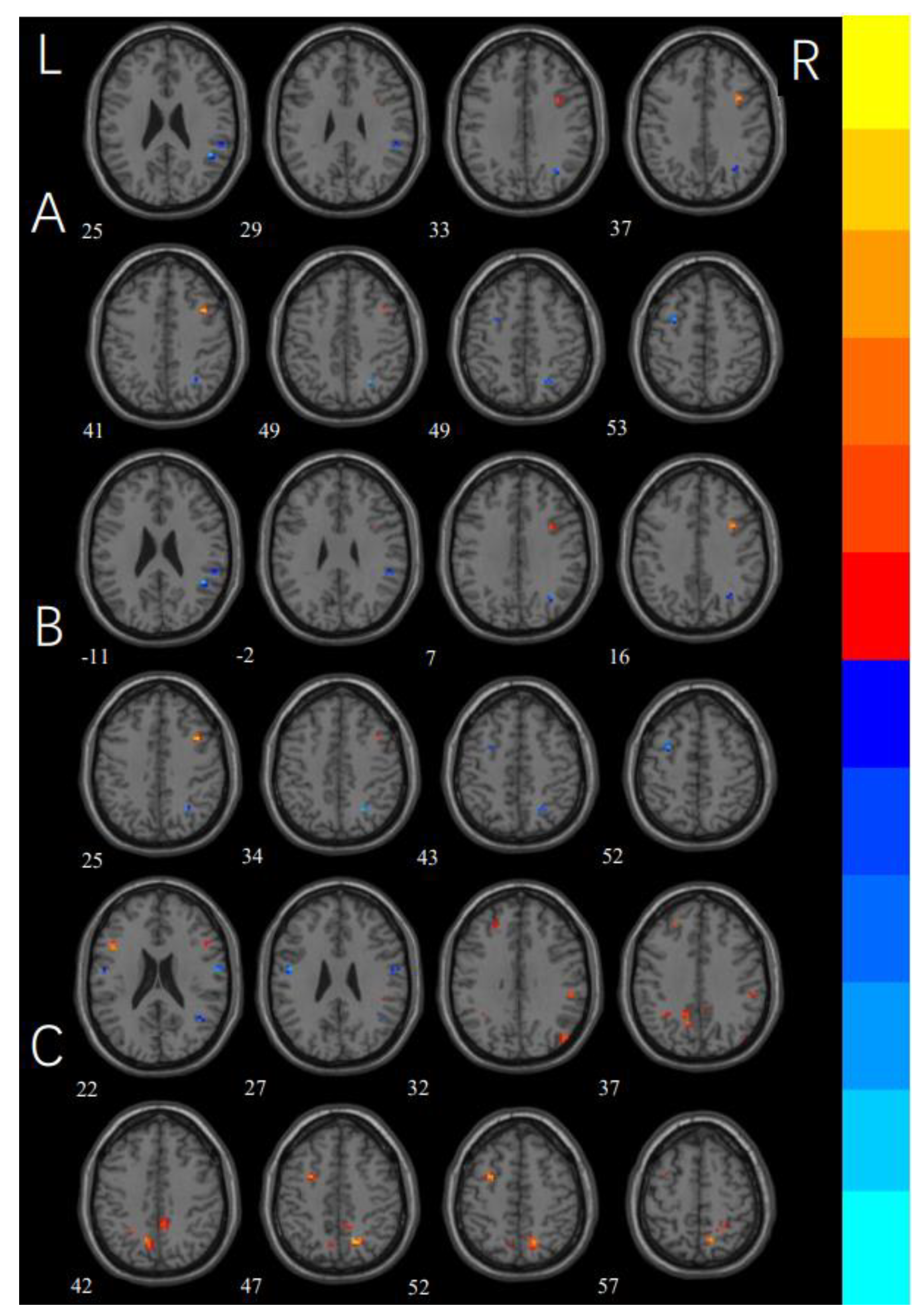 Brainsci 12 00998 g002
