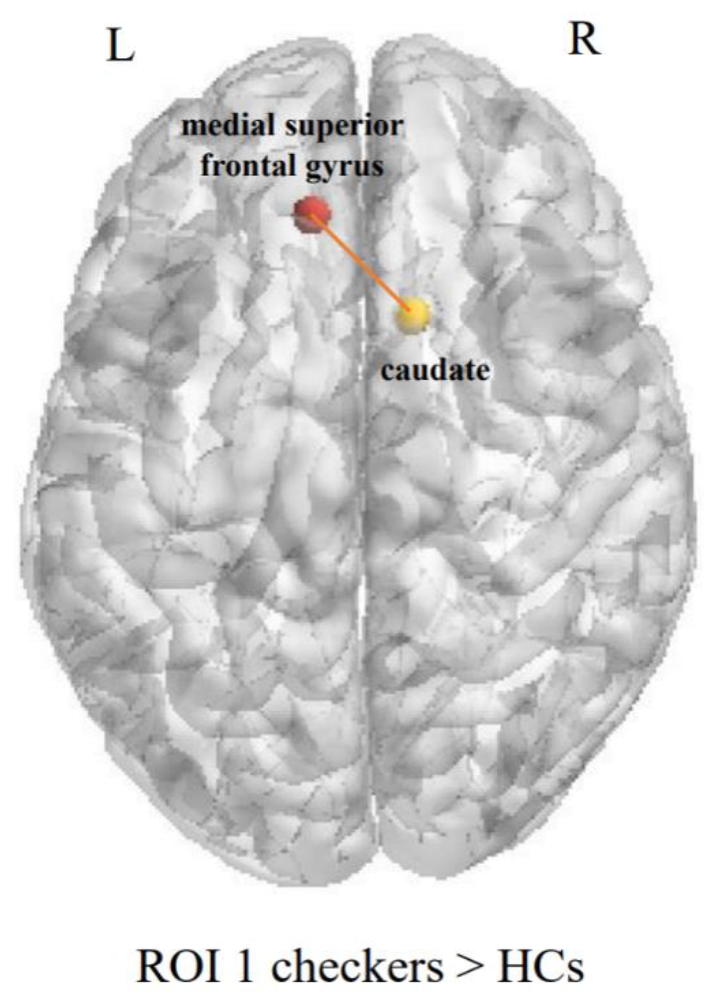 Brainsci 12 00998 g006