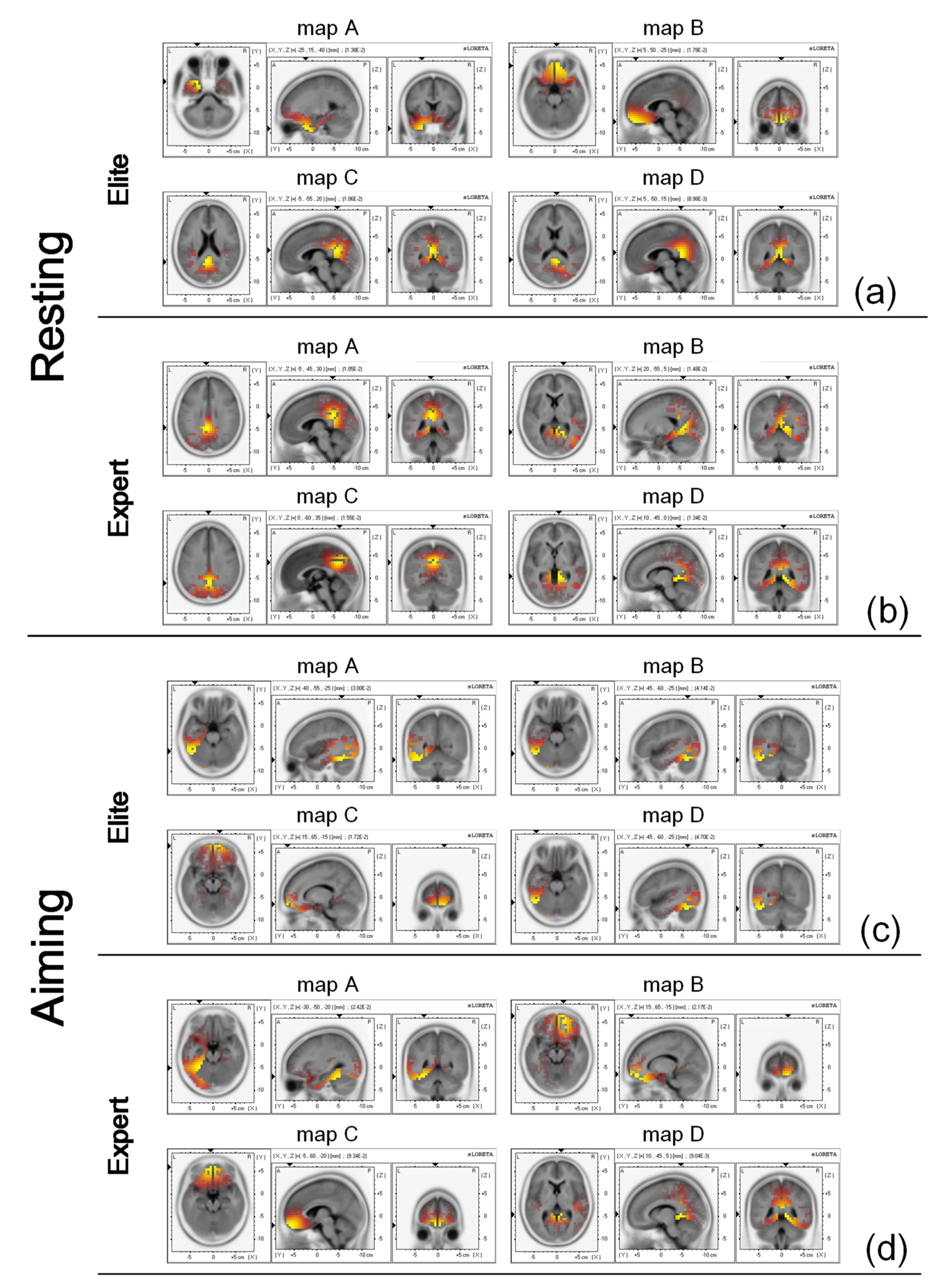 Brainsci 12 01017 g006 Brainsci 12 01017 g006