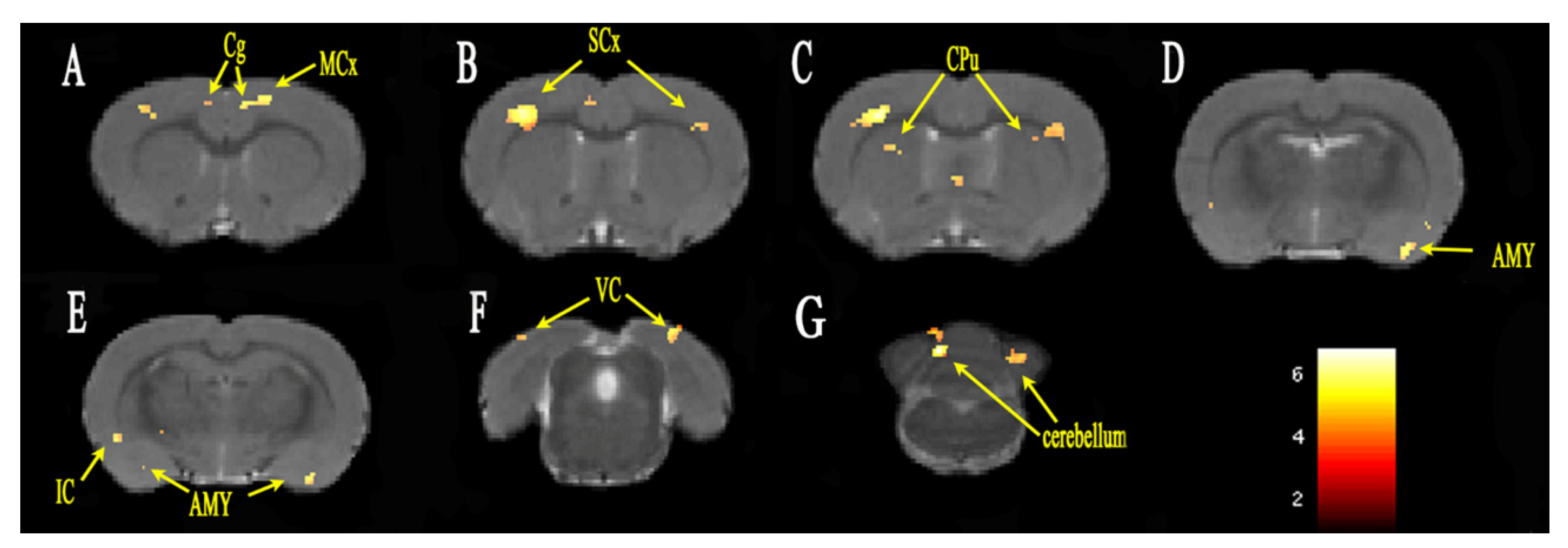 Brainsci 12 01029 g002 550