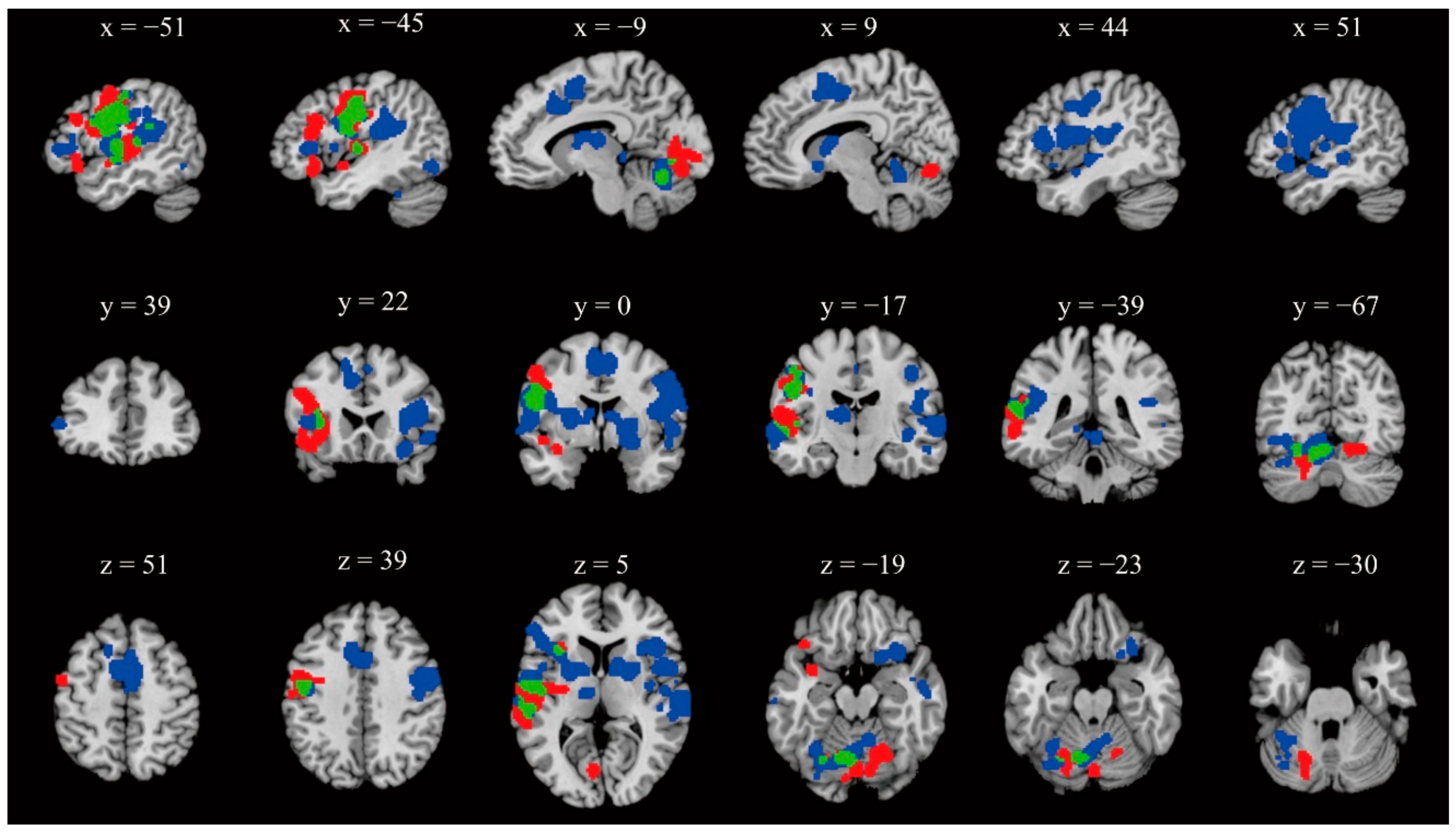 Brainsci 12 01030 g002 Brainsci 12 01030 g002