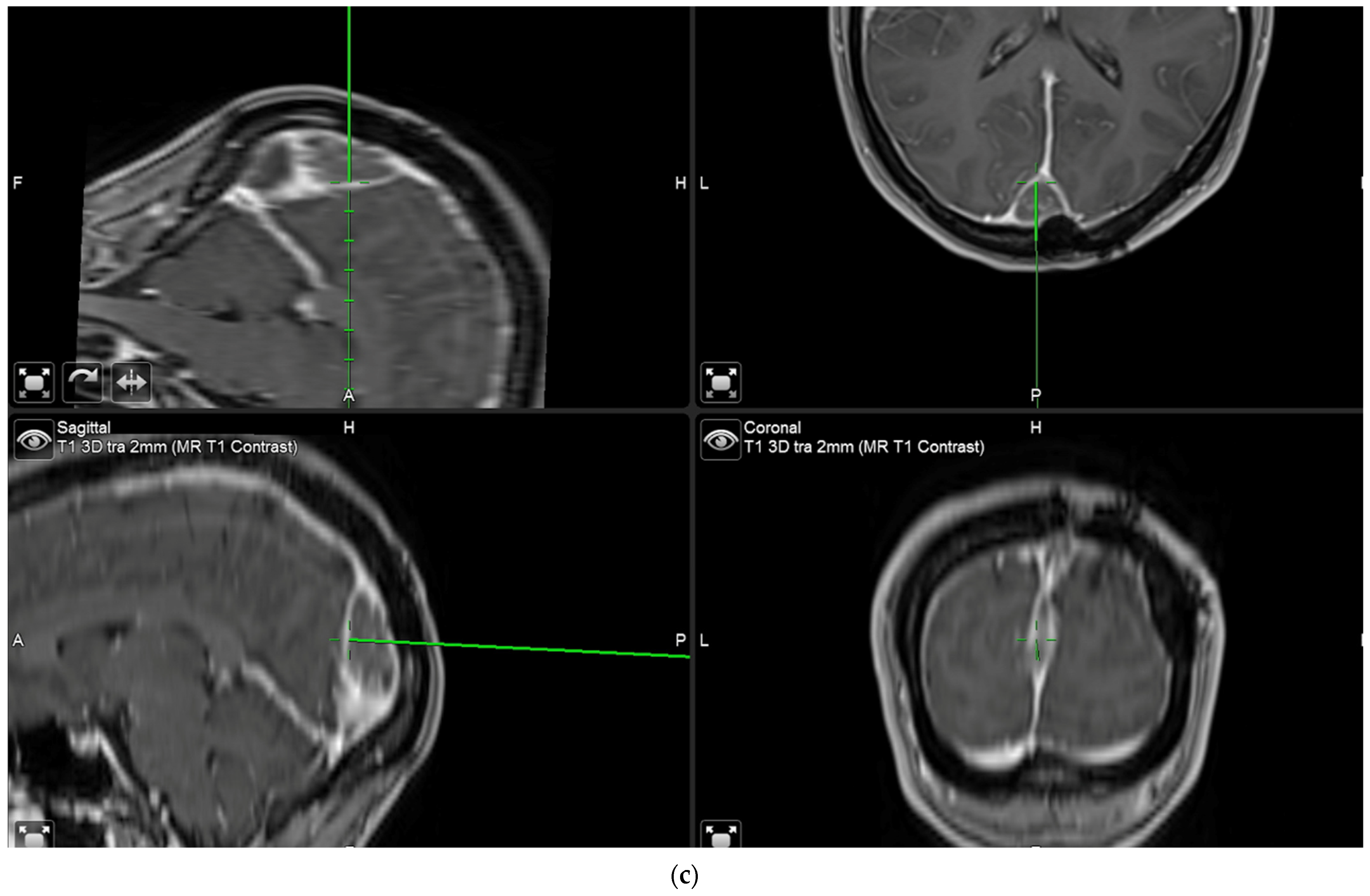 Brainsci 12 01044 g001b 550