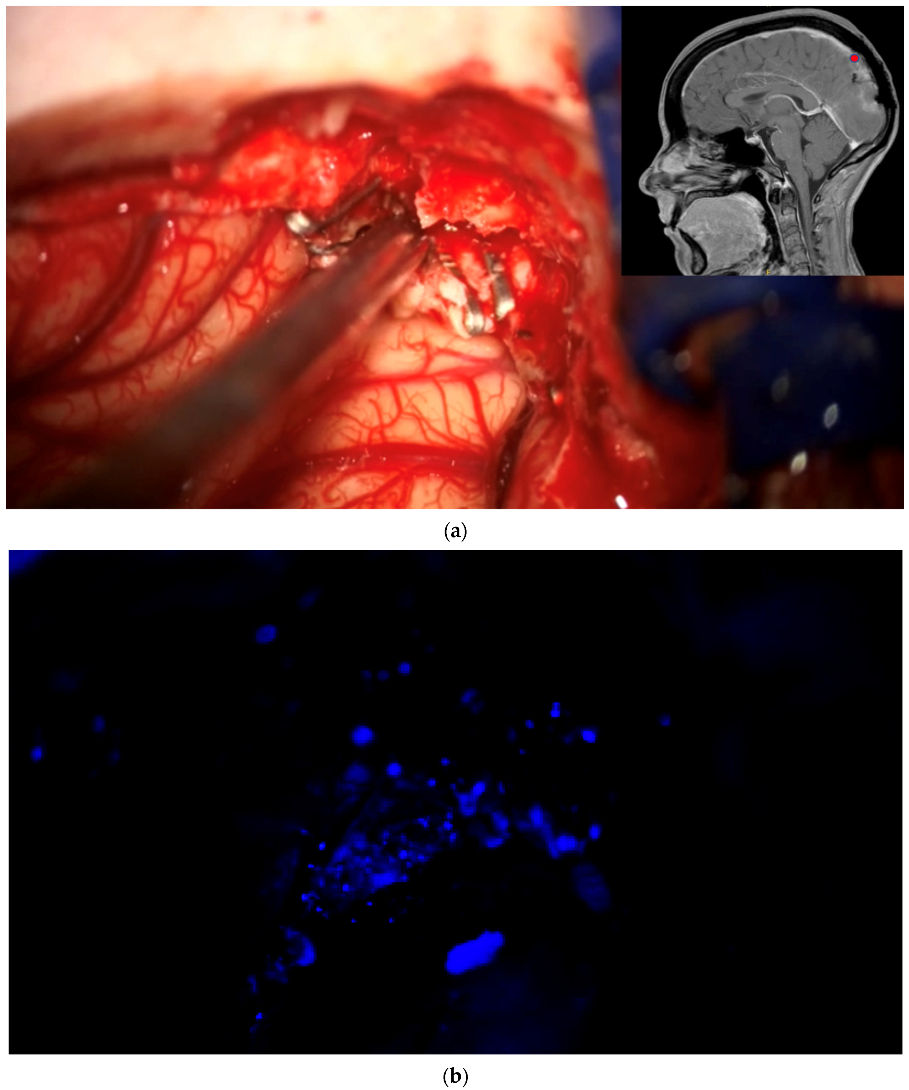 Brainsci 12 01044 g002a 550