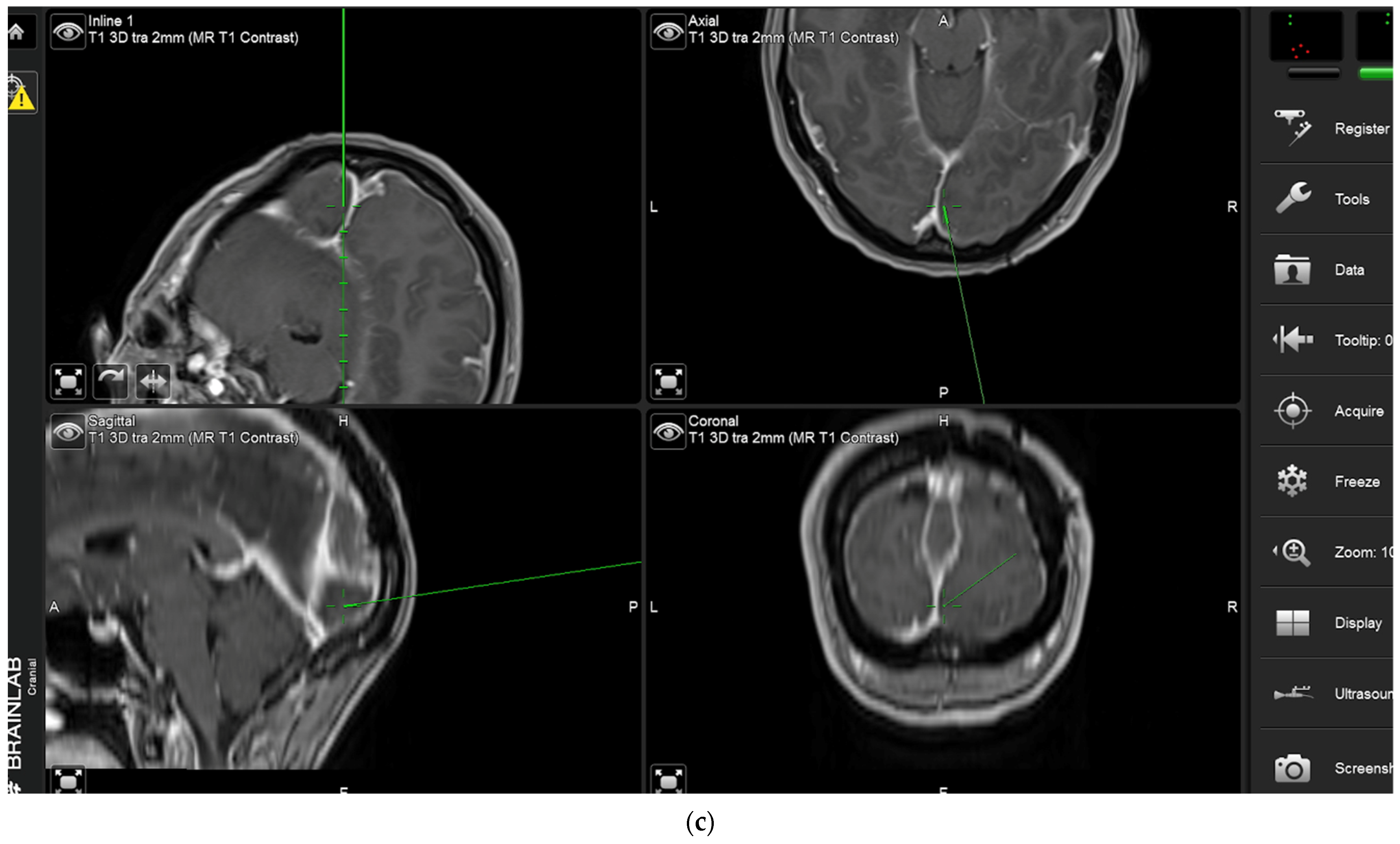 Brainsci 12 01044 g002b 550