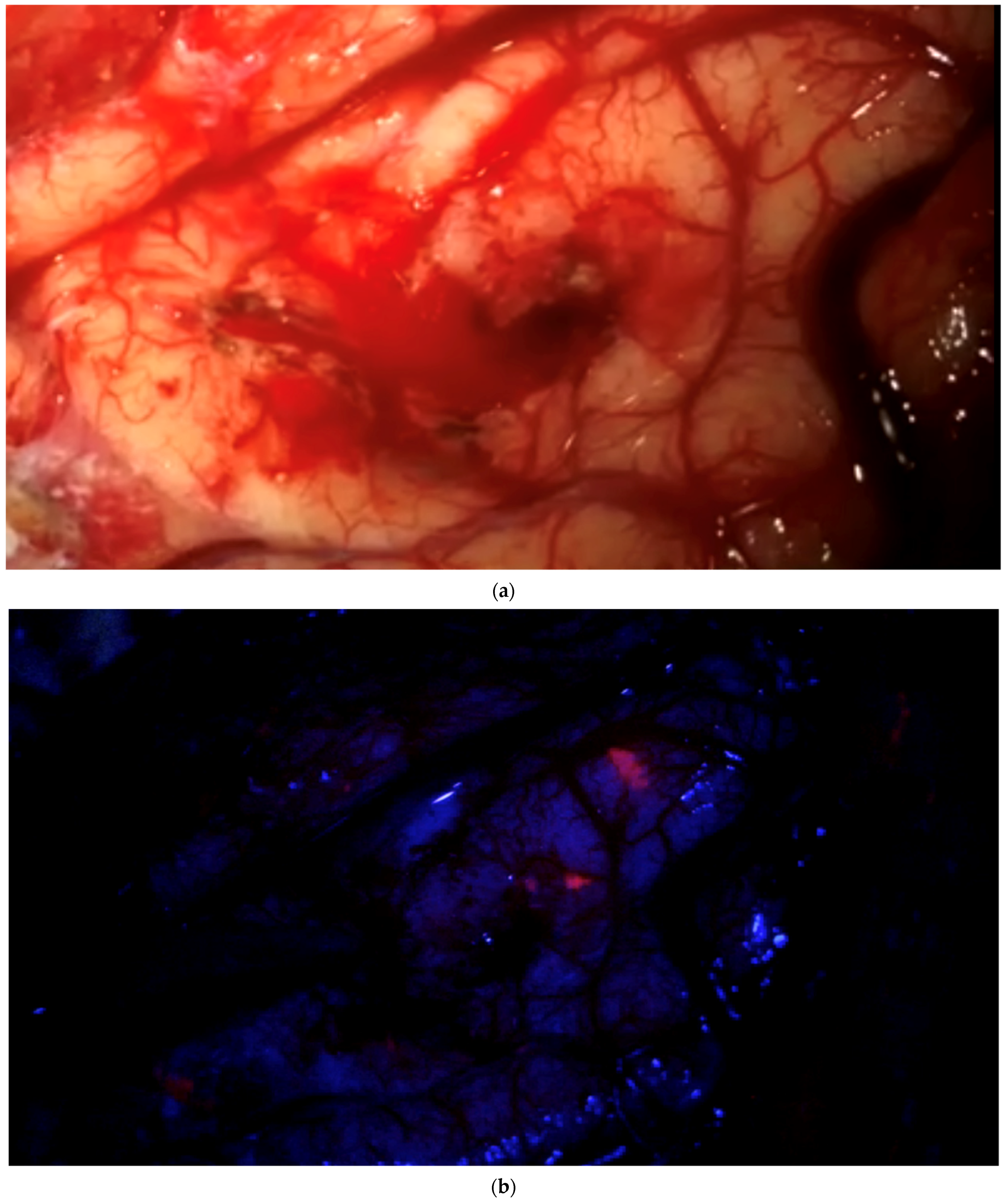 Brainsci 12 01044 g003a 550