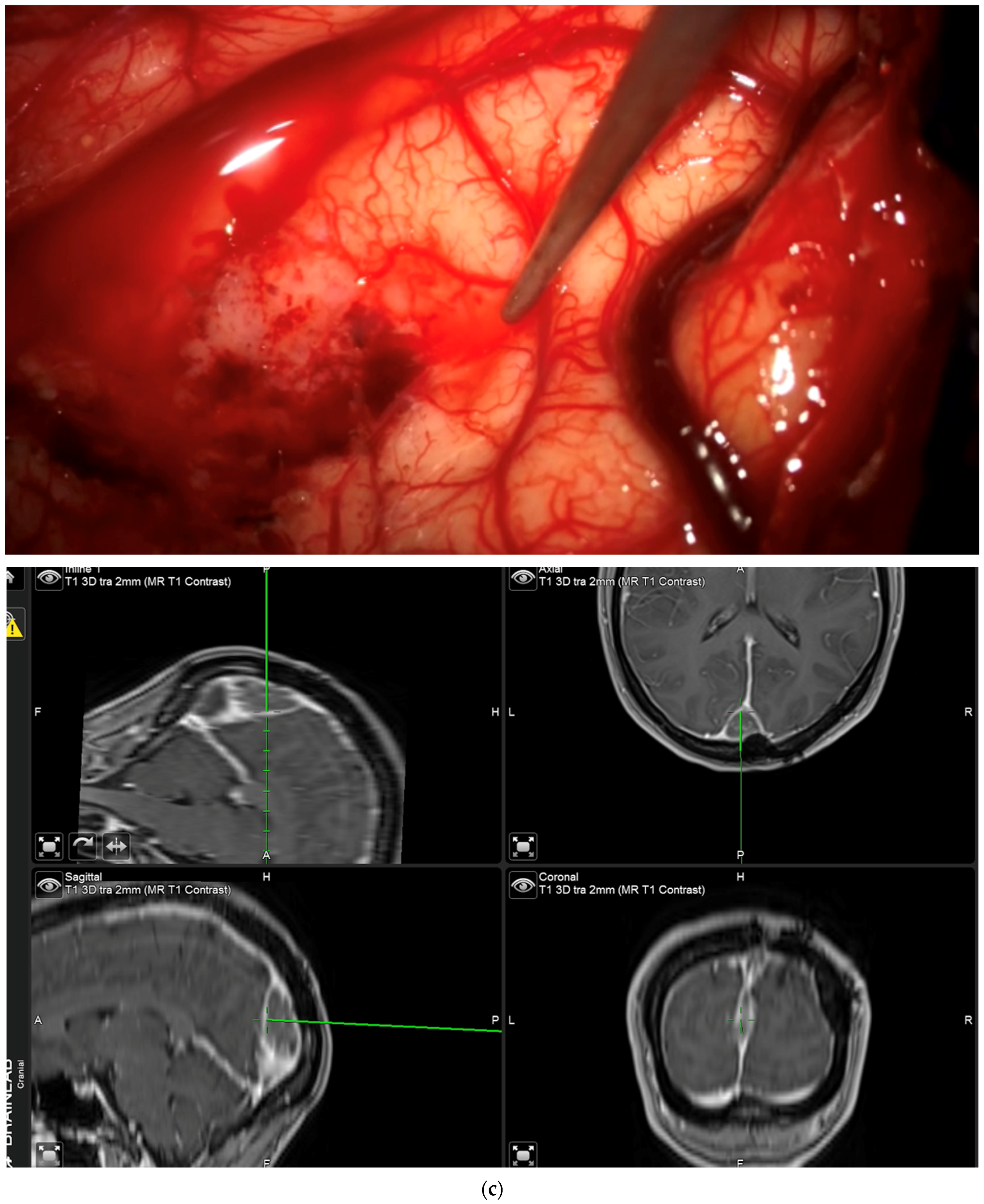 Brainsci 12 01044 g003b 550