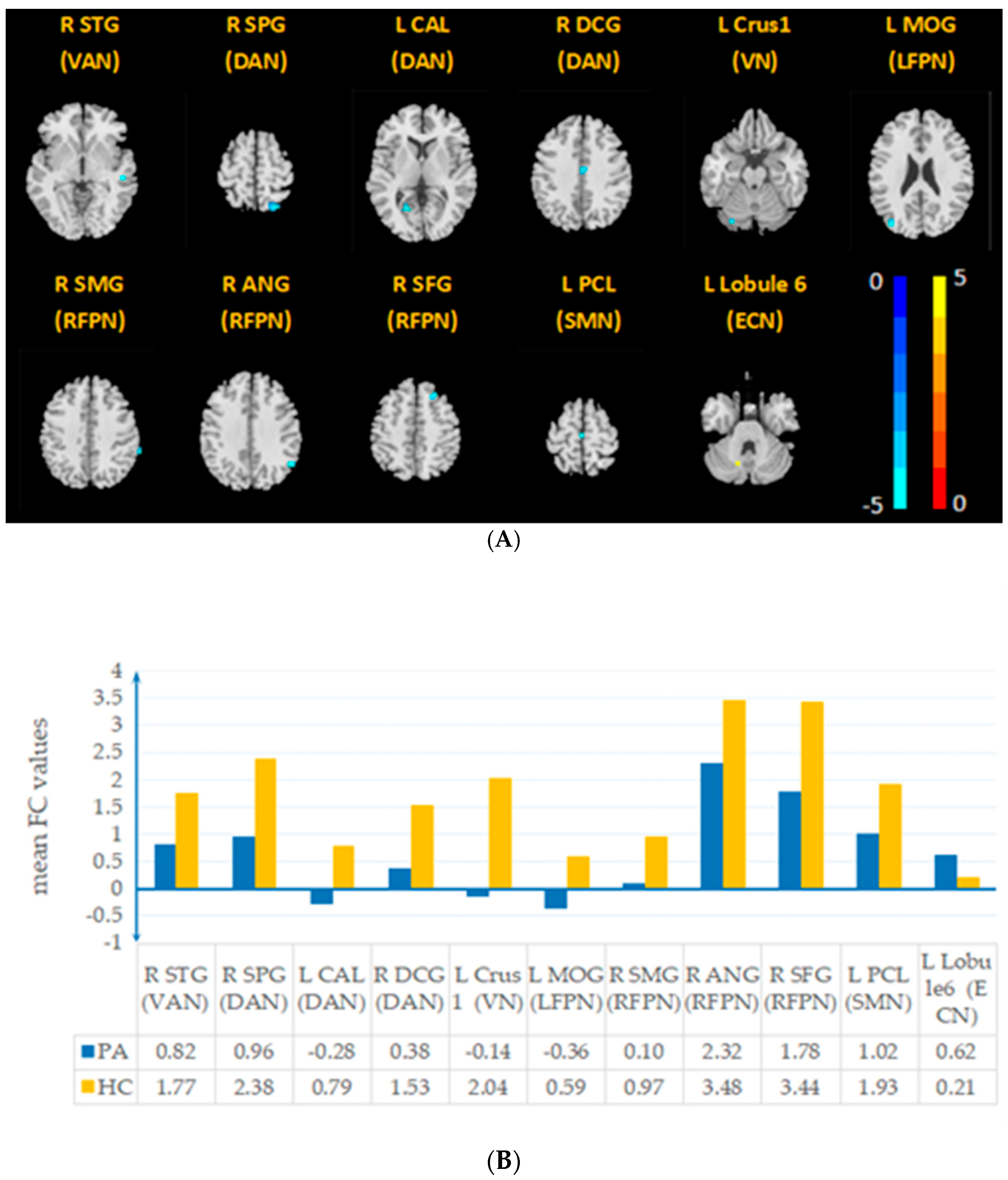 Brainsci 12 01049 g002 Brainsci 12 01049 g002