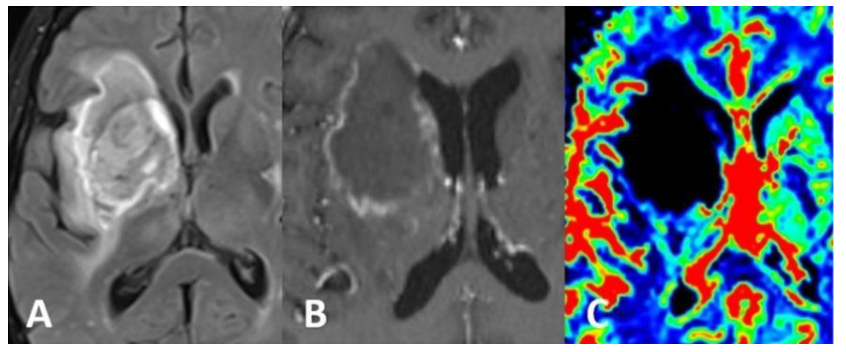 Brainsci 12 01050 g002 550