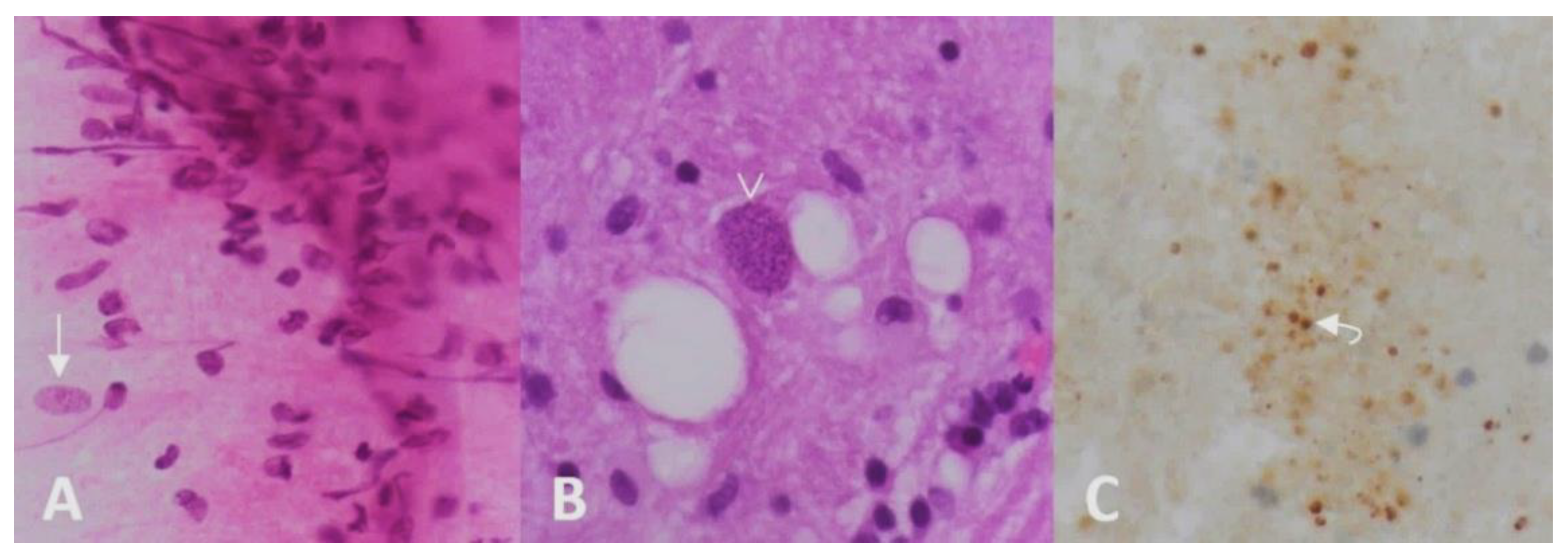 Brainsci 12 01050 g003 550