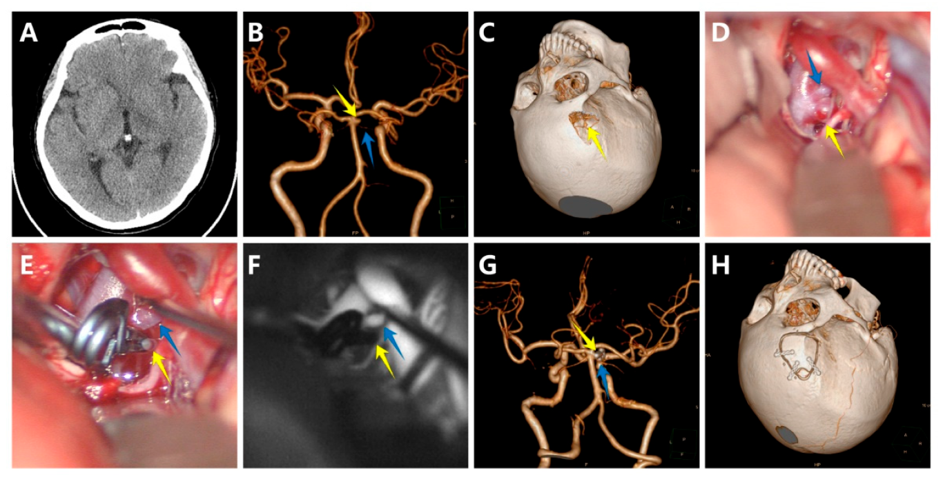 Brainsci 12 01066 g002 Brainsci 12 01066 g002