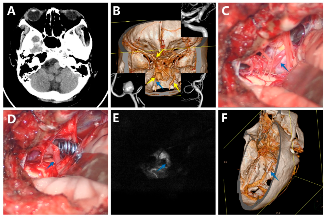 Brainsci 12 01066 g003 Brainsci 12 01066 g003