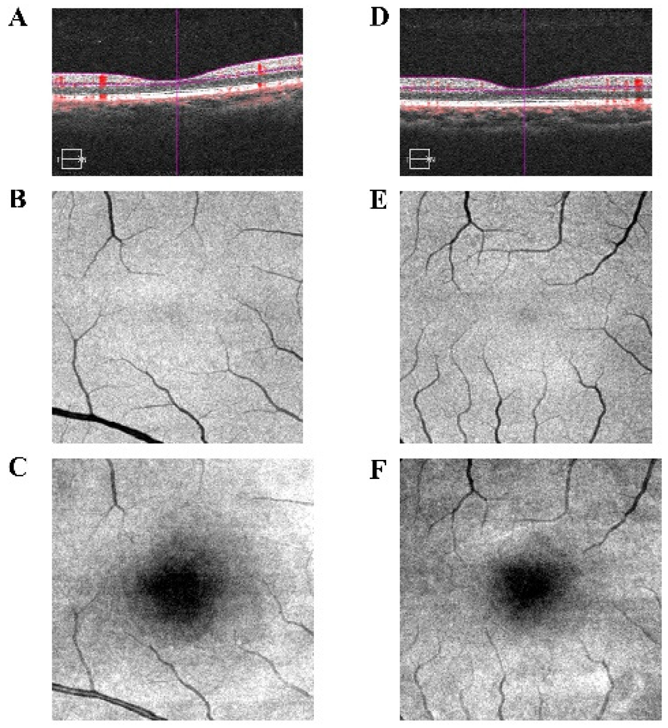Brainsci 12 01078 g002 Brainsci 12 01078 g002