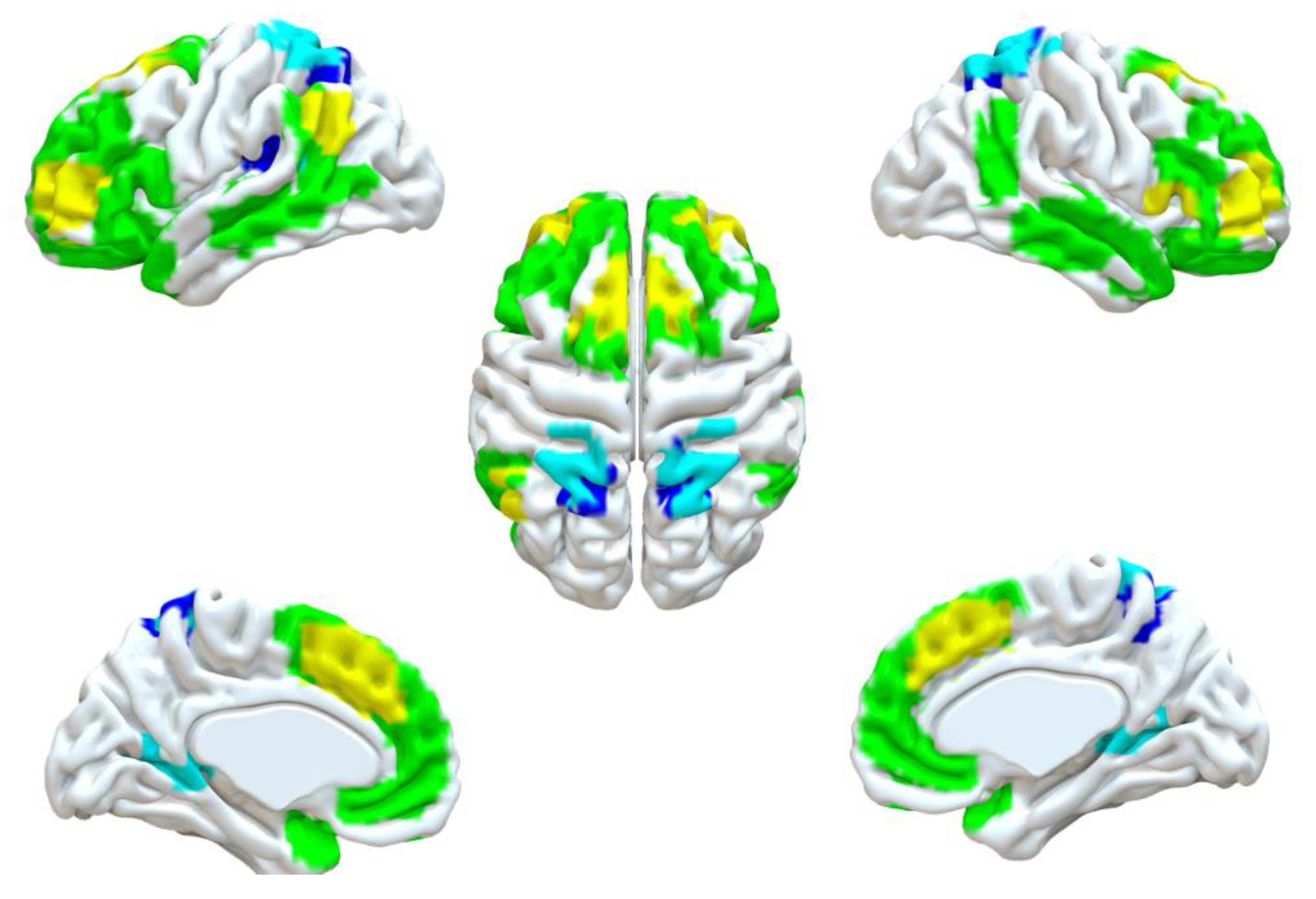 Brainsci 12 01112 g002 550