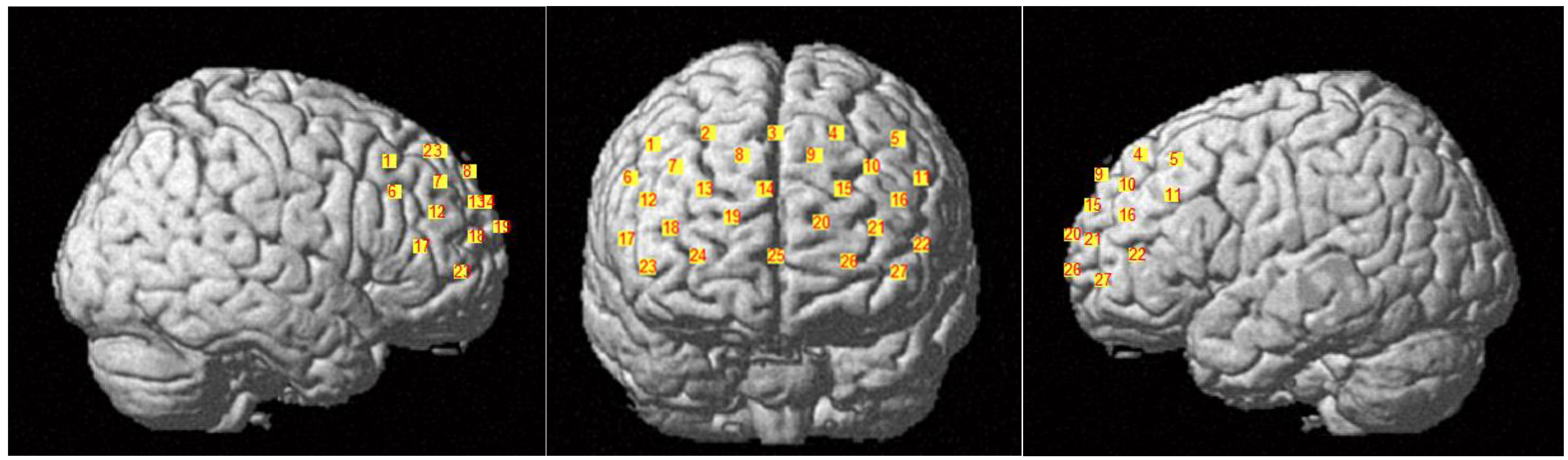 Brainsci 12 01148 g002