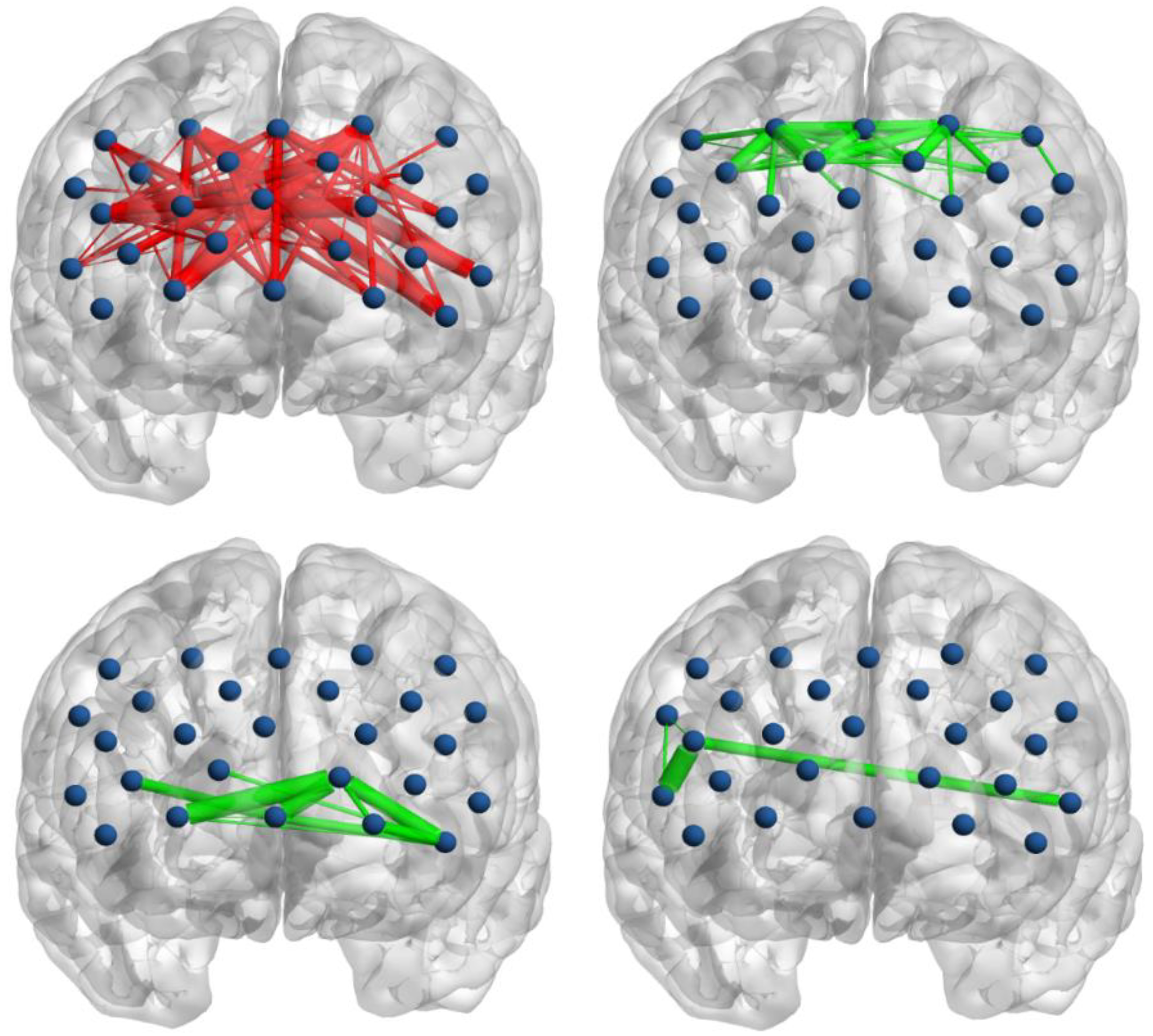 Brainsci 12 01148 g004