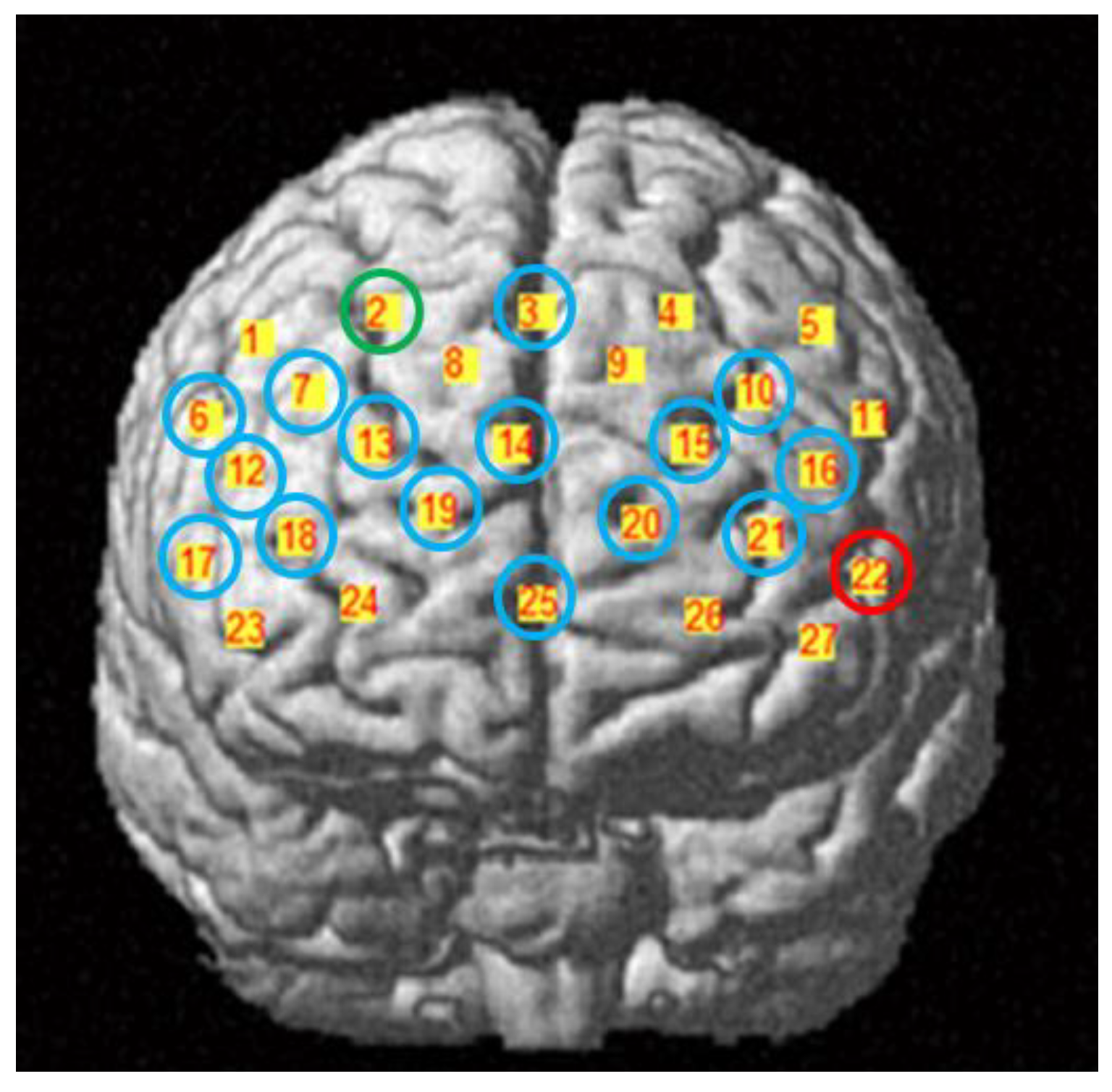 Brainsci 12 01148 g006