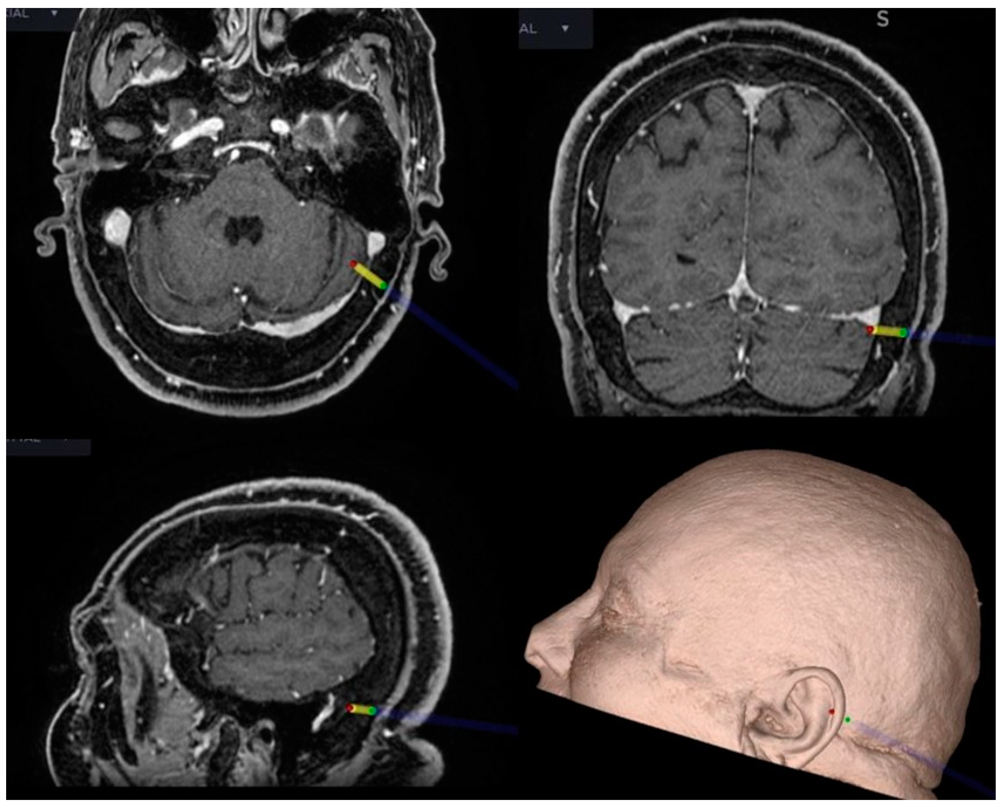 Brainsci 12 01167 g003 Brainsci 12 01167 g003