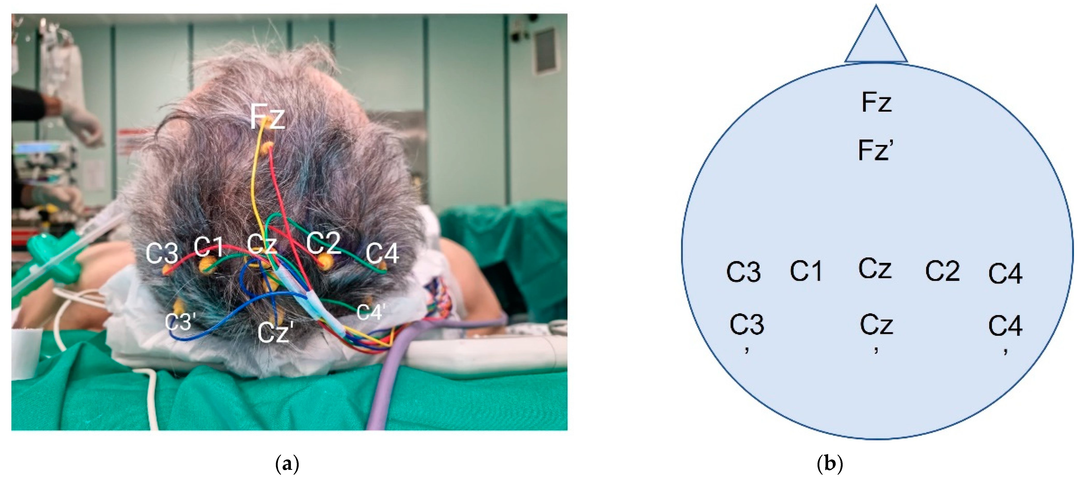 Brainsci 12 01167 g004 Brainsci 12 01167 g004