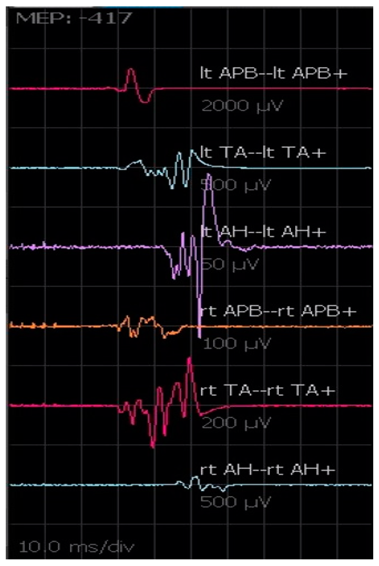 Brainsci 12 01167 g006 Brainsci 12 01167 g006