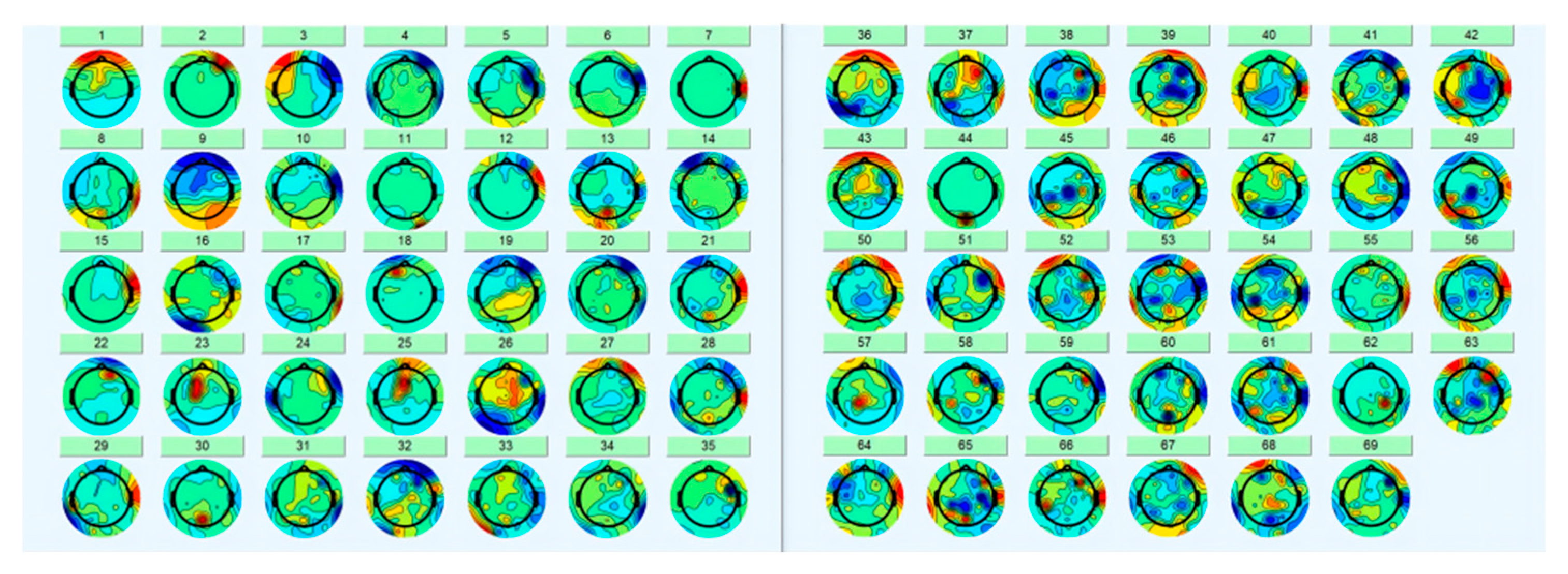 Brainsci 12 01173 g006