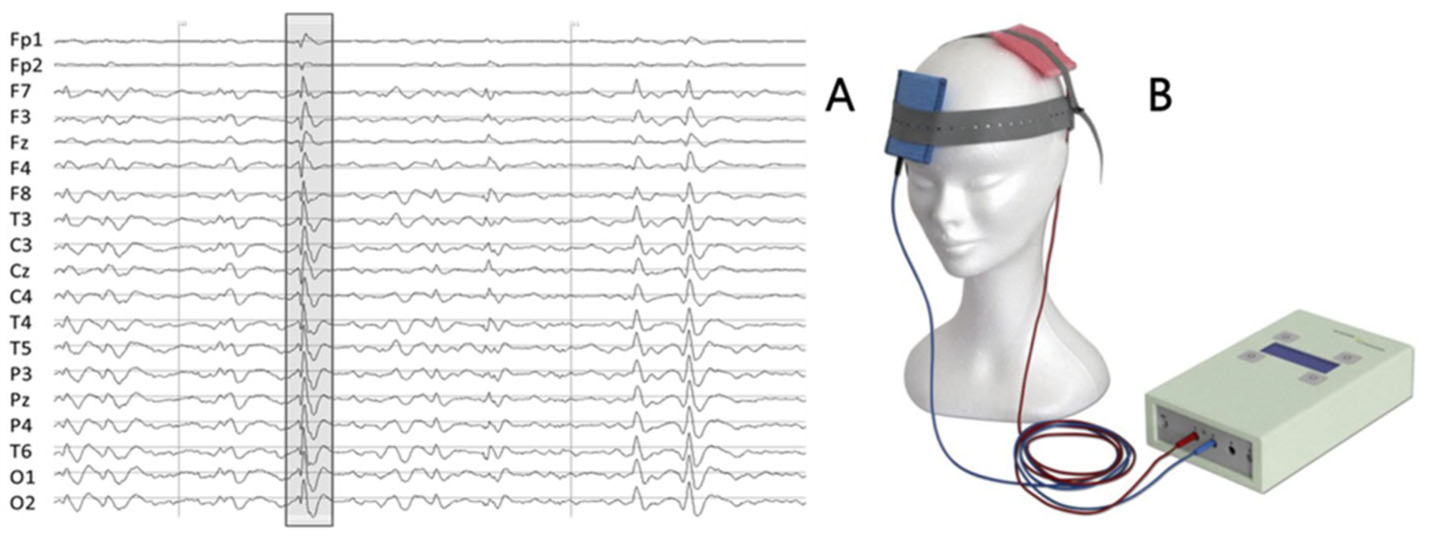 Brainsci 12 01179 g002 Brainsci 12 01179 g002