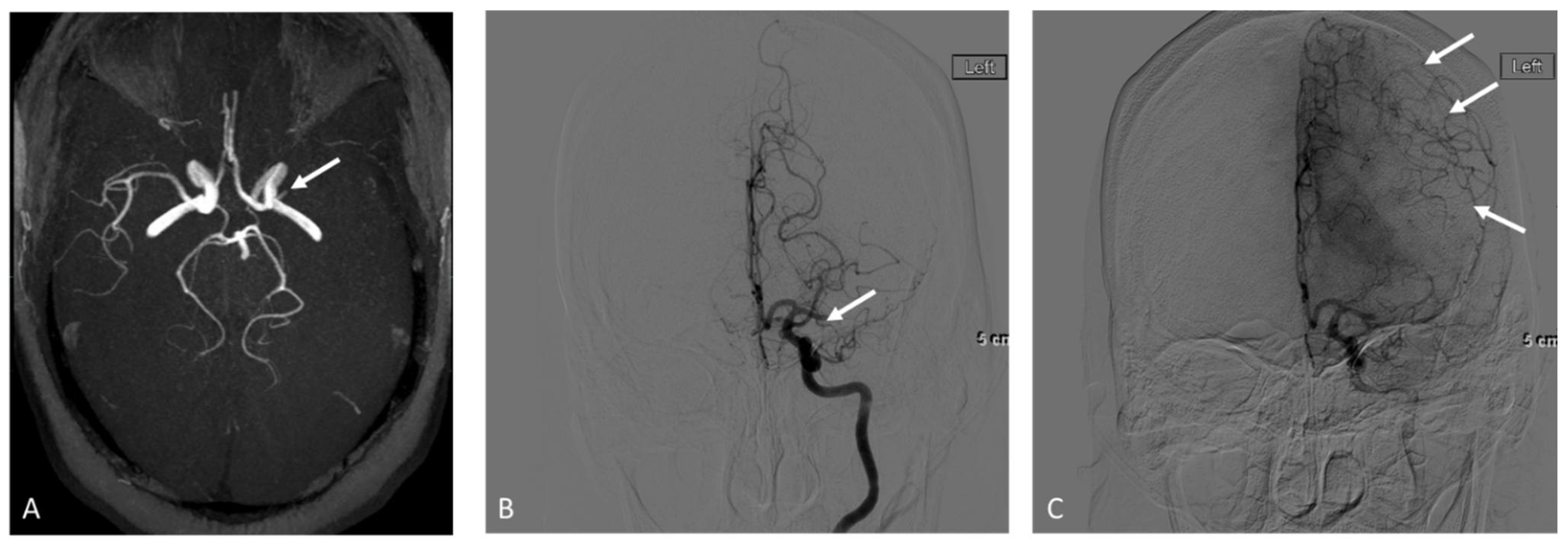 Brainsci 12 01181 g002 550
