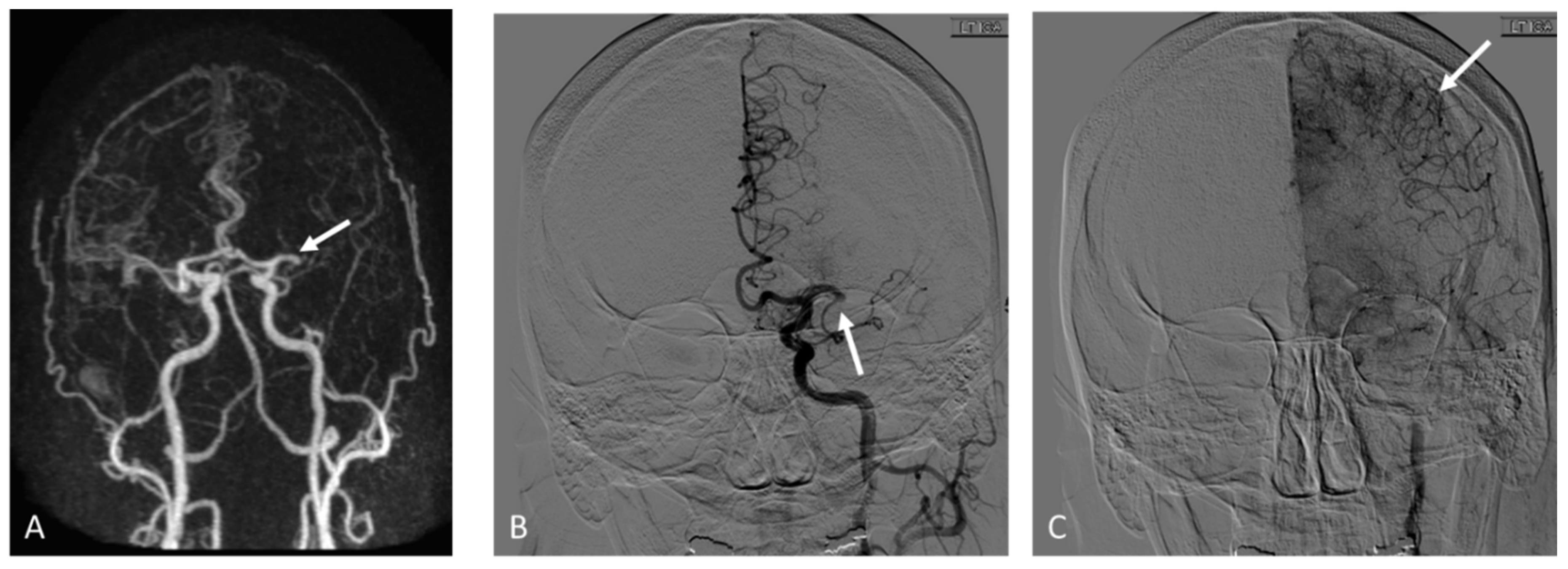 Brainsci 12 01181 g003 550