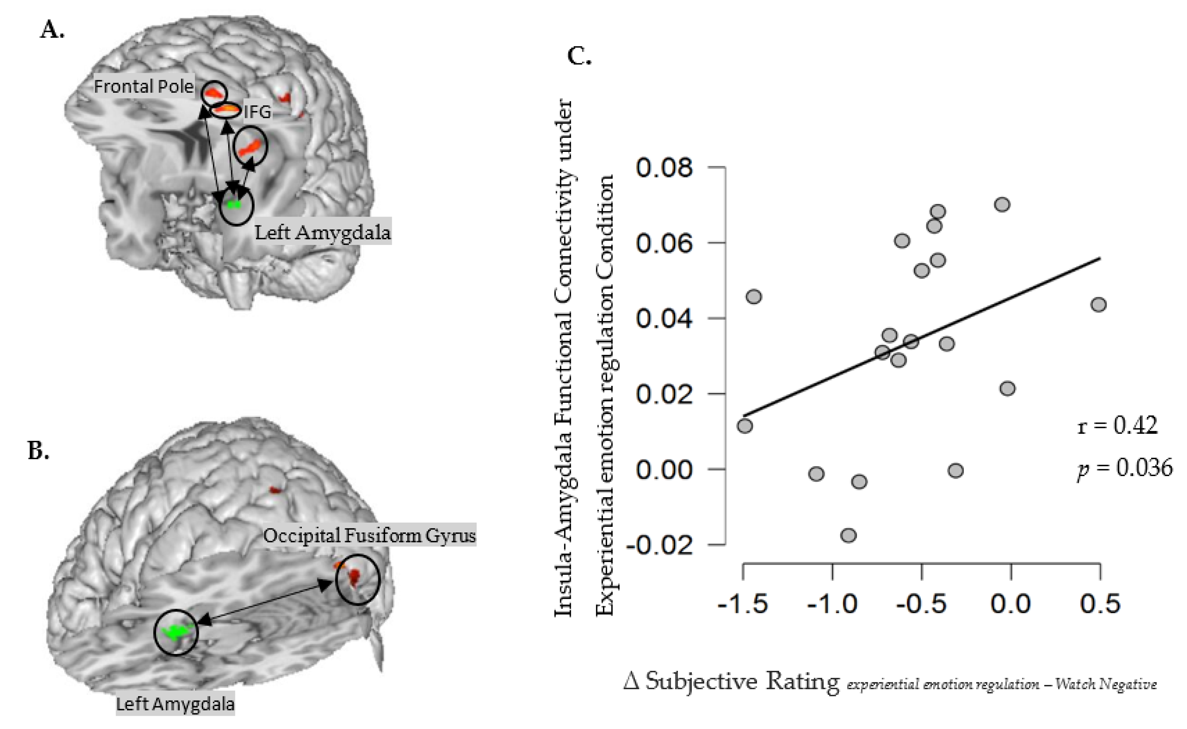 Brainsci 12 01215 g004 Brainsci 12 01215 g004