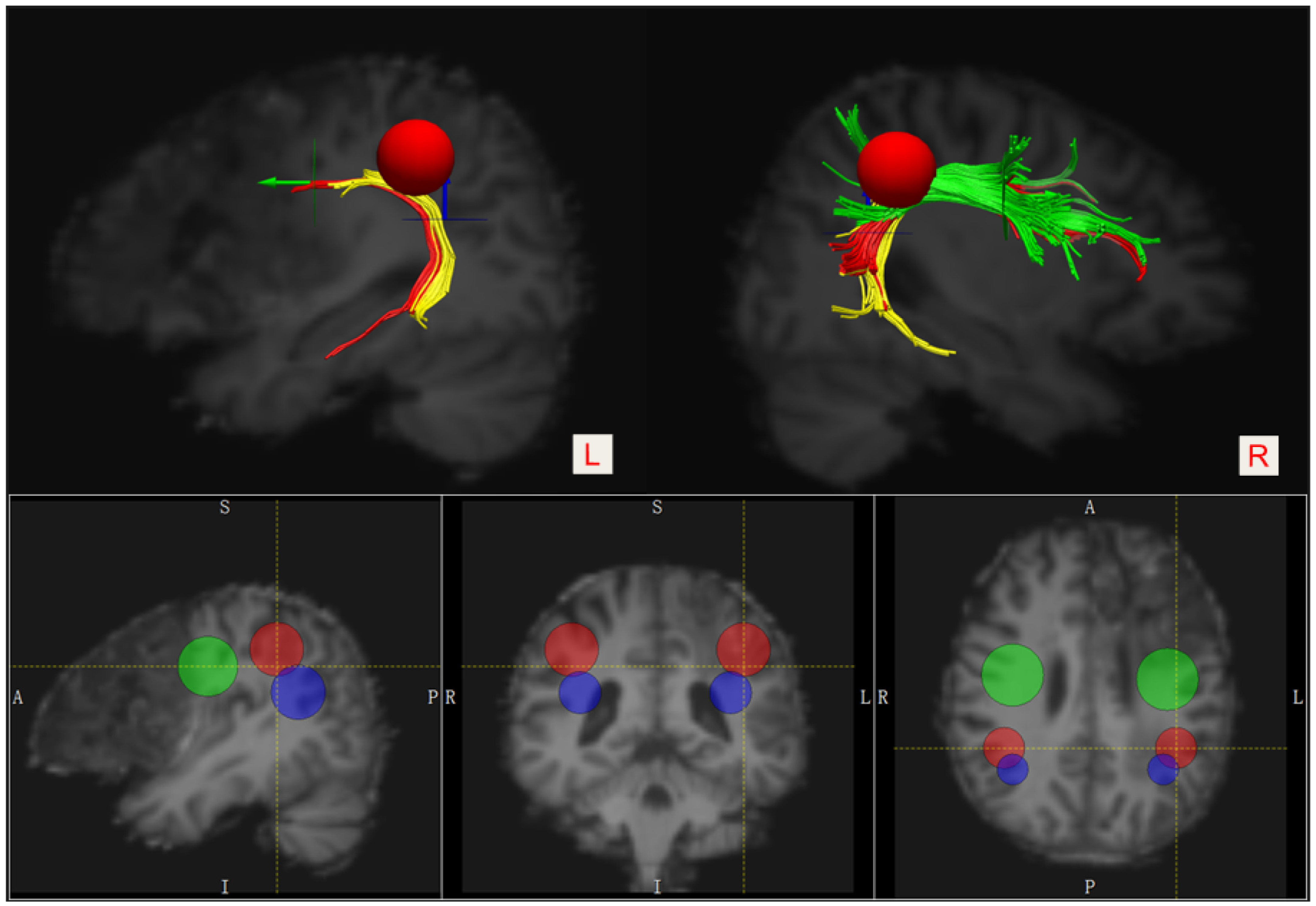 Brainsci 12 01253 g002