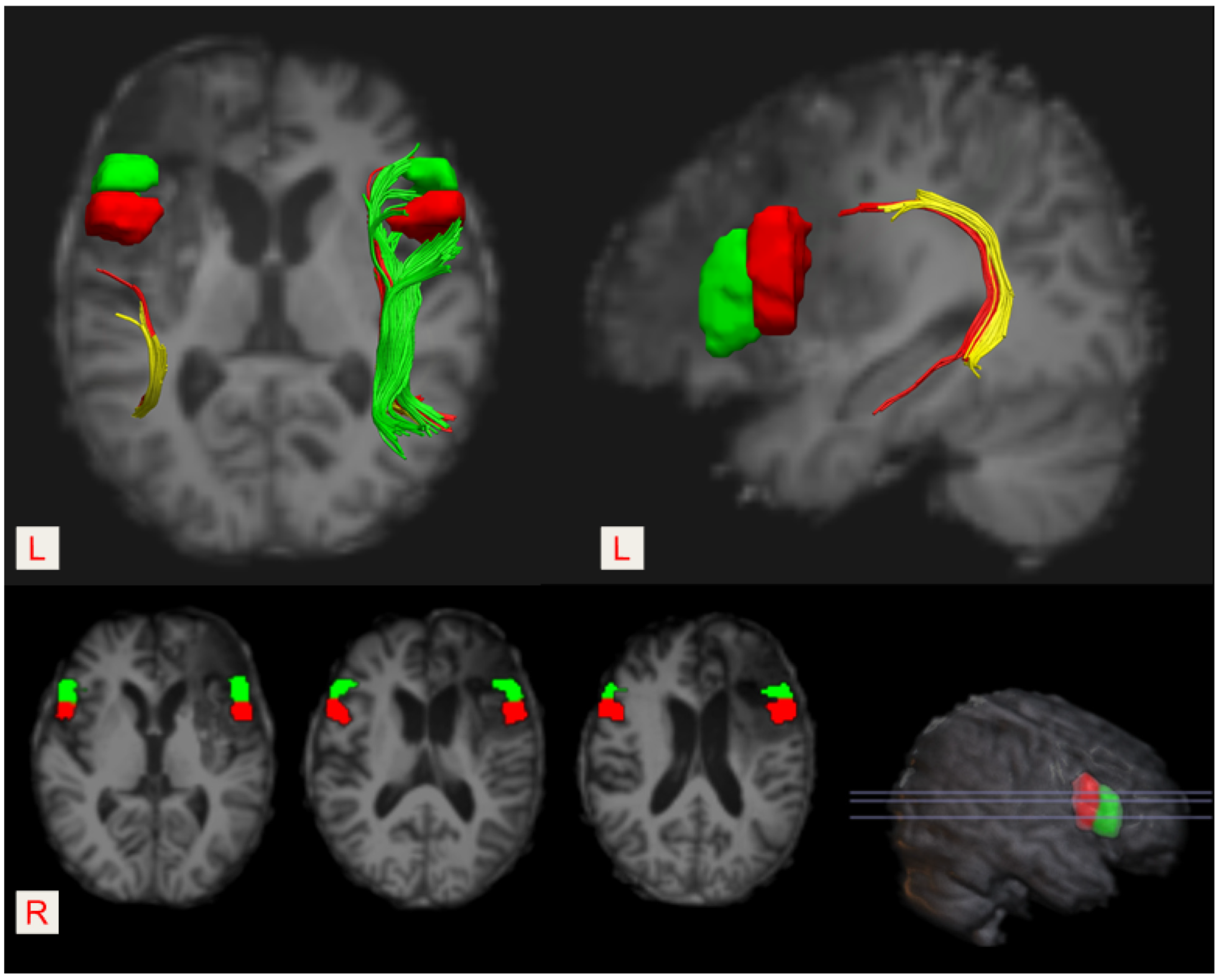 Brainsci 12 01253 g003
