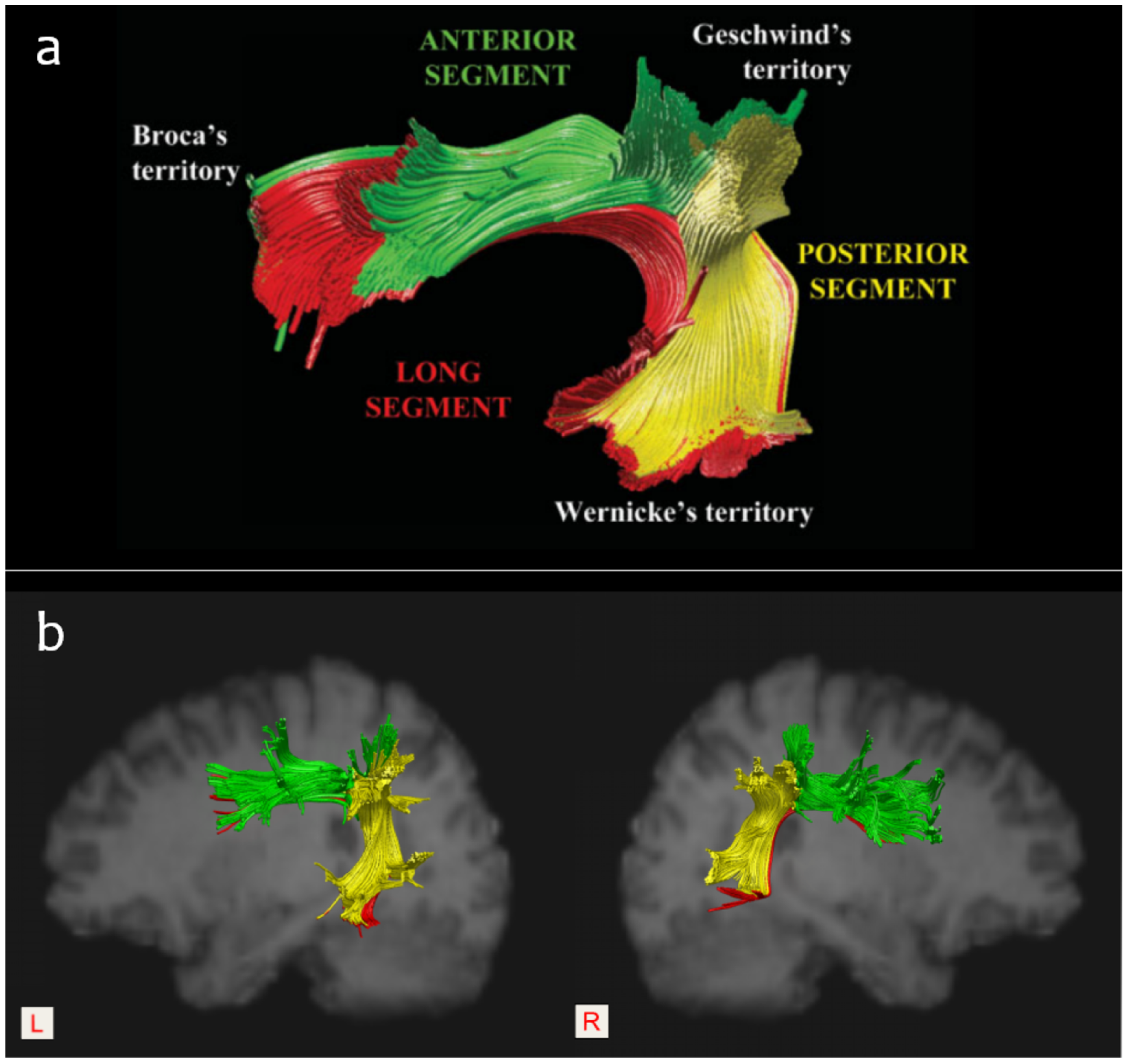Brainsci 12 01253 g004