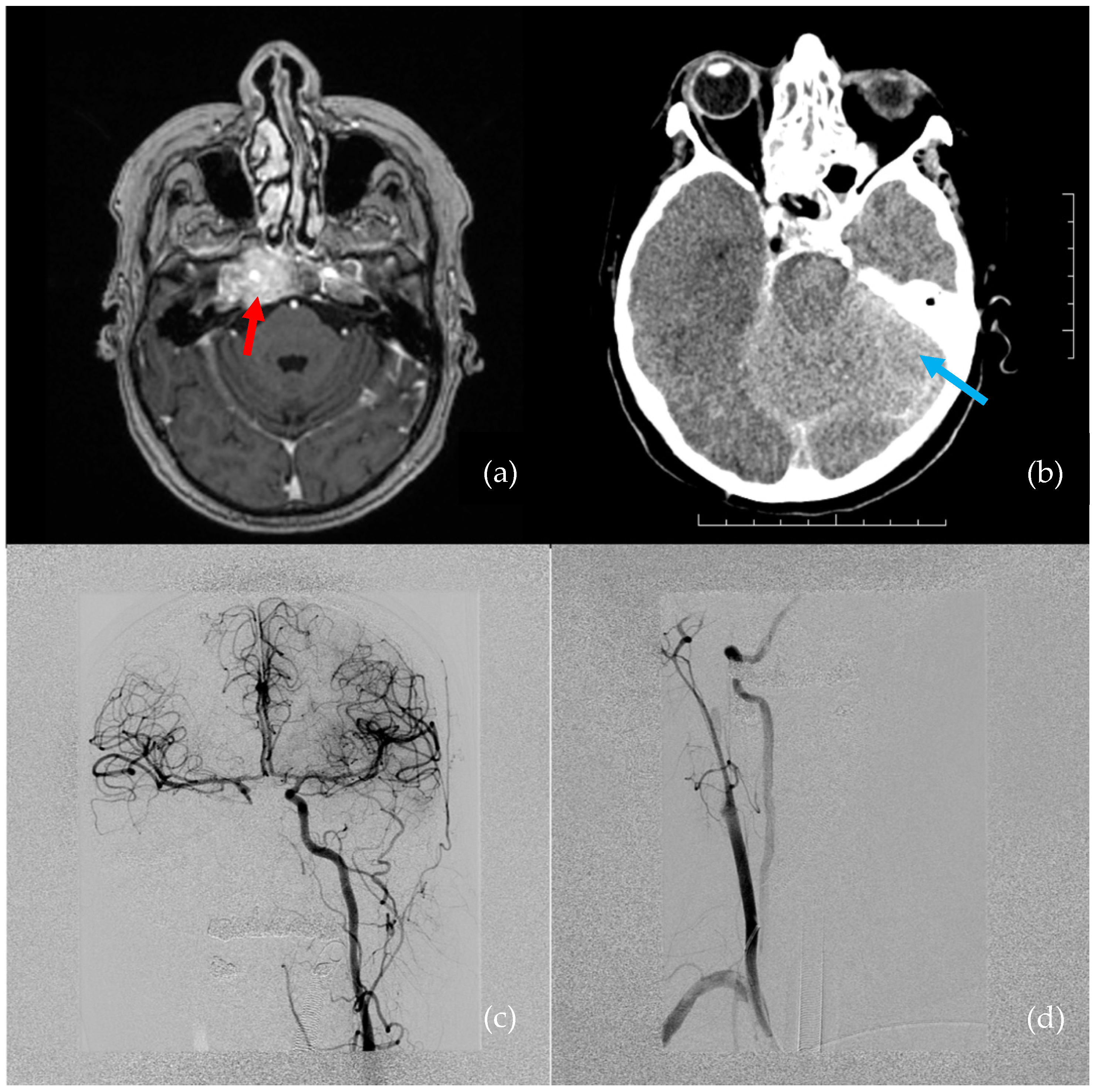 Brainsci 12 01254 g001