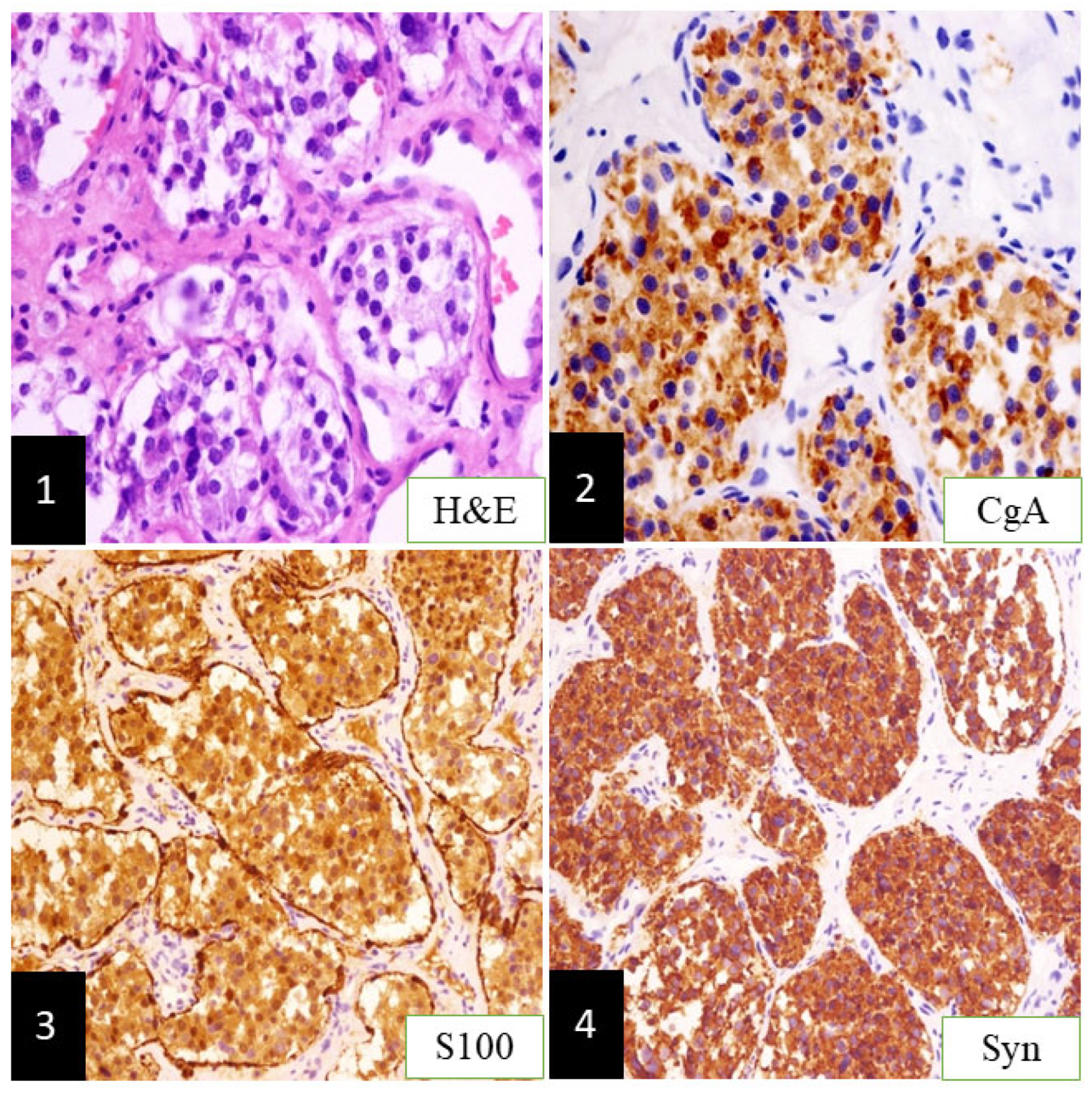 Brainsci 12 01257 g002