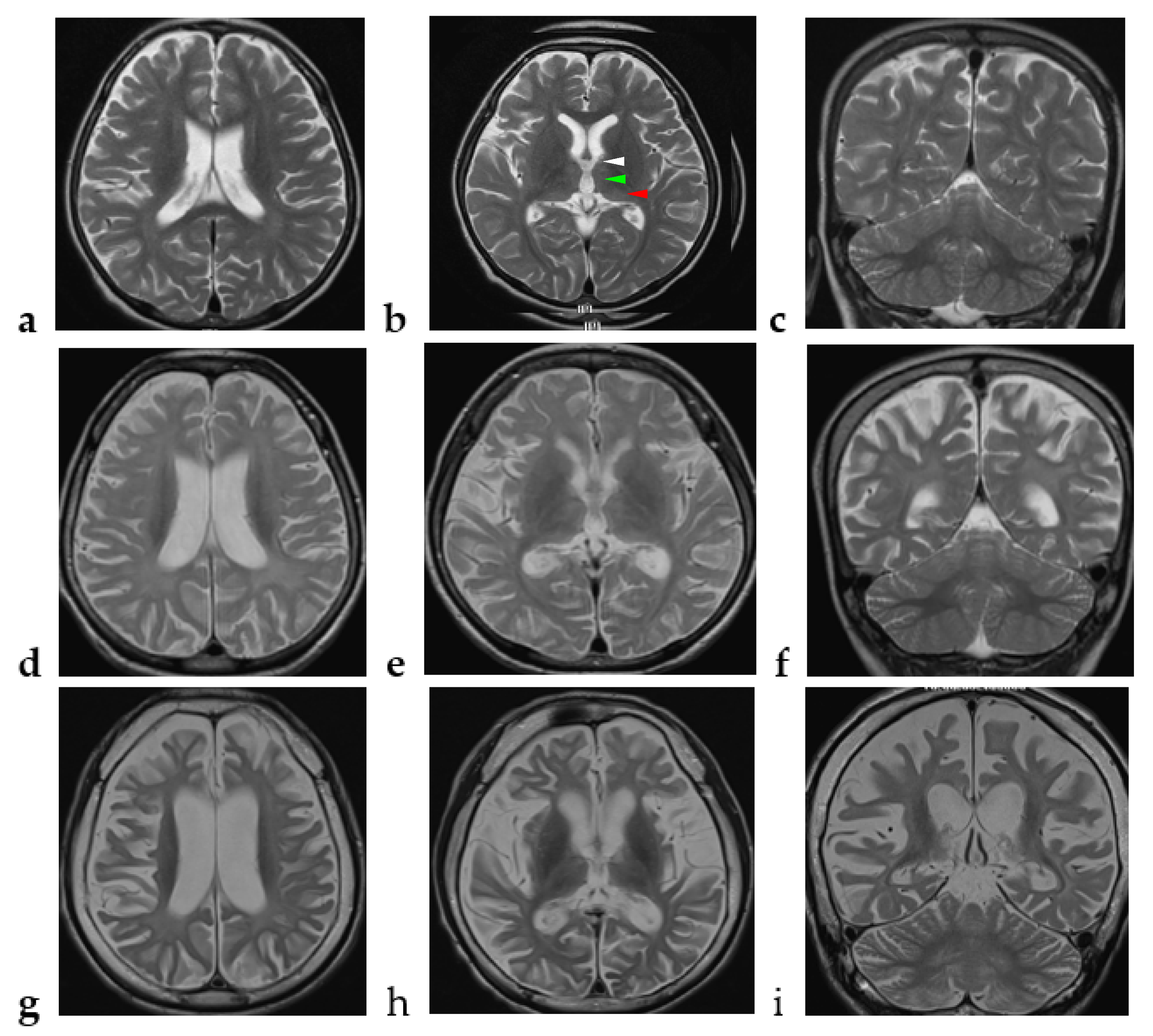 Brainsci 12 01262 g001 550