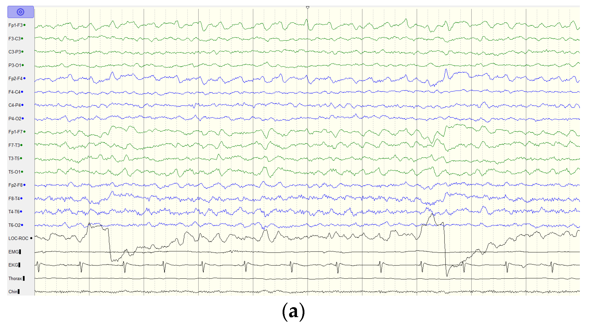 Brainsci 12 01262 g003a 550