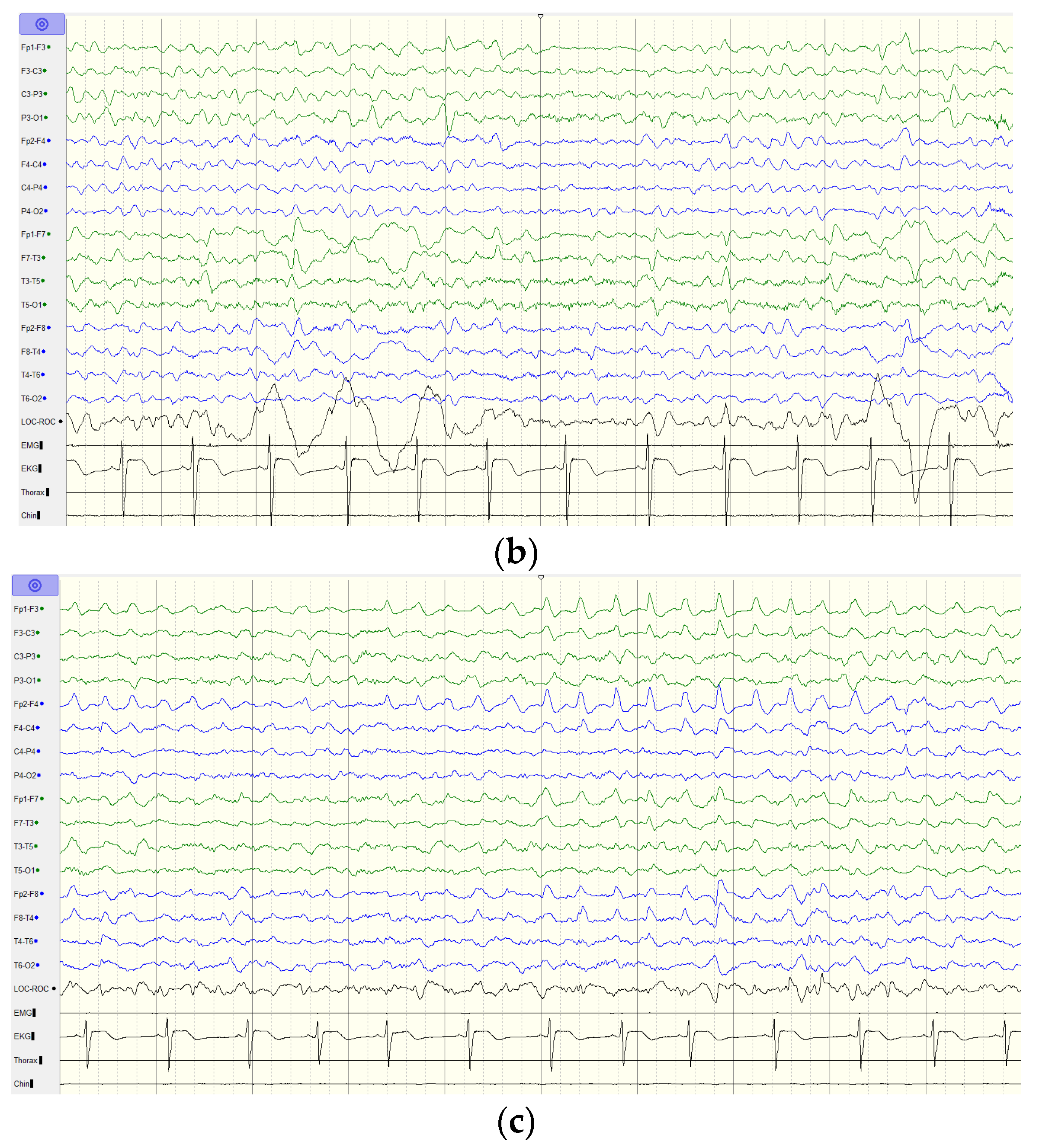 Brainsci 12 01262 g003b 550