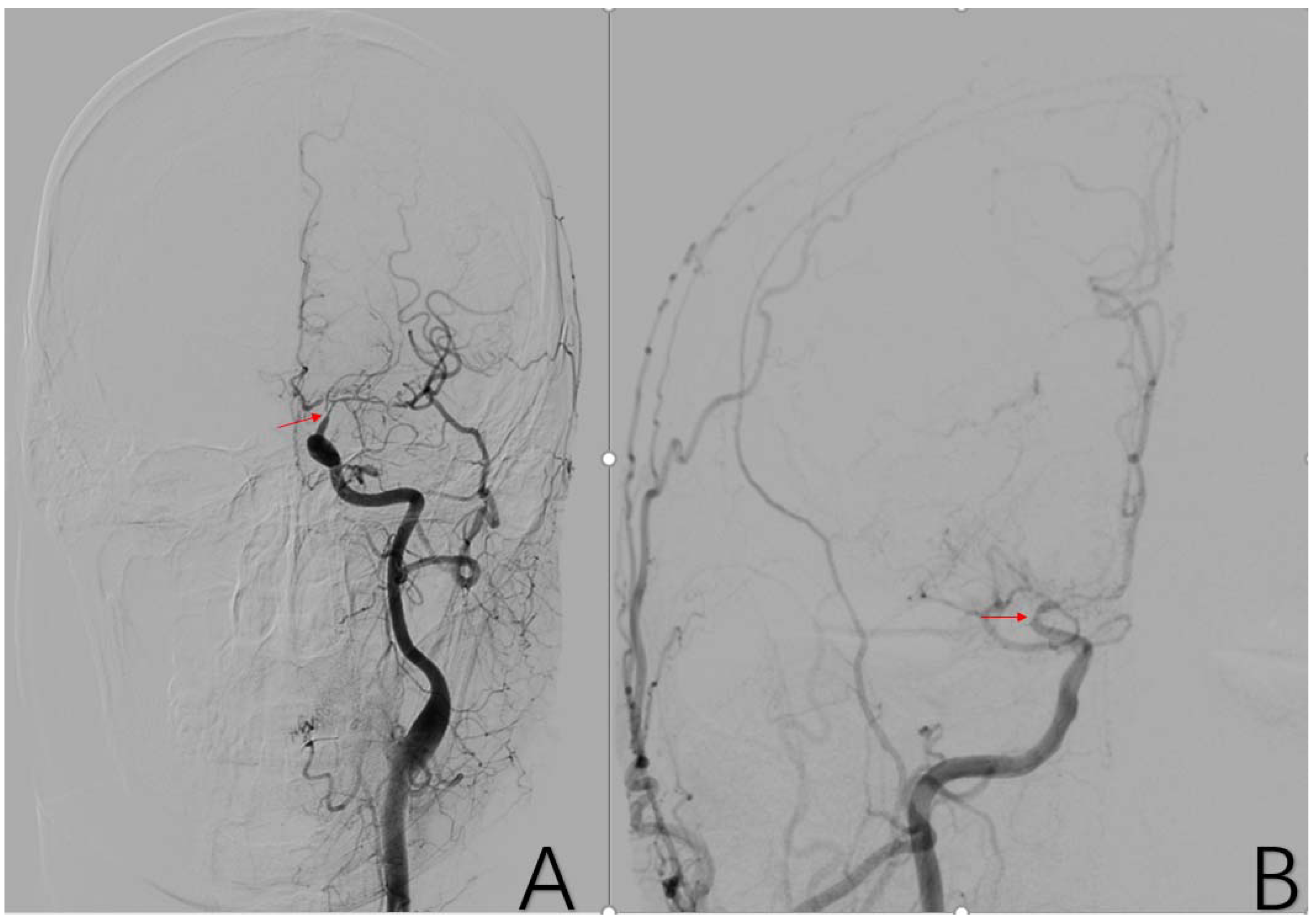 Brainsci 12 01270 g004