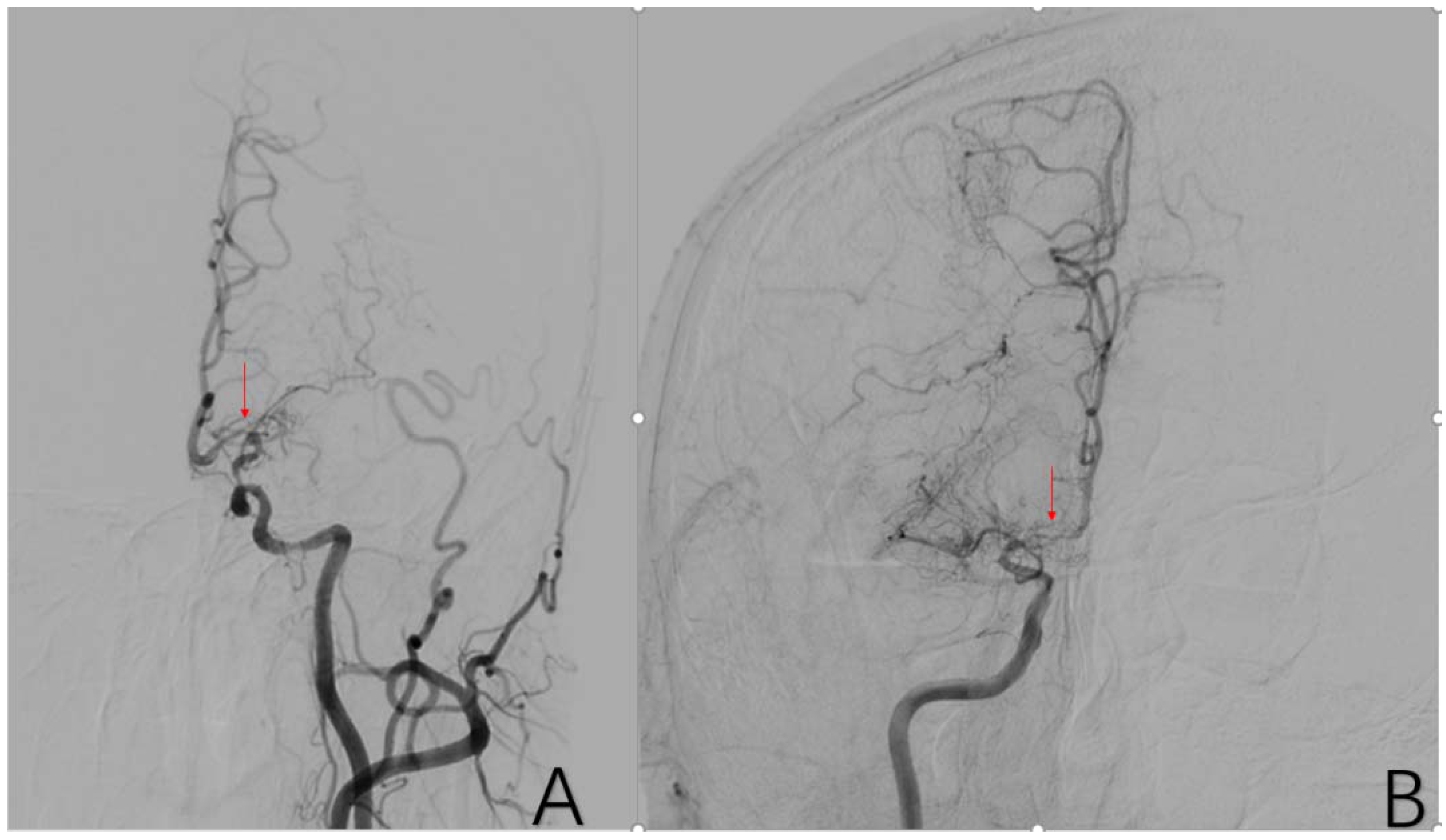 Brainsci 12 01270 g005