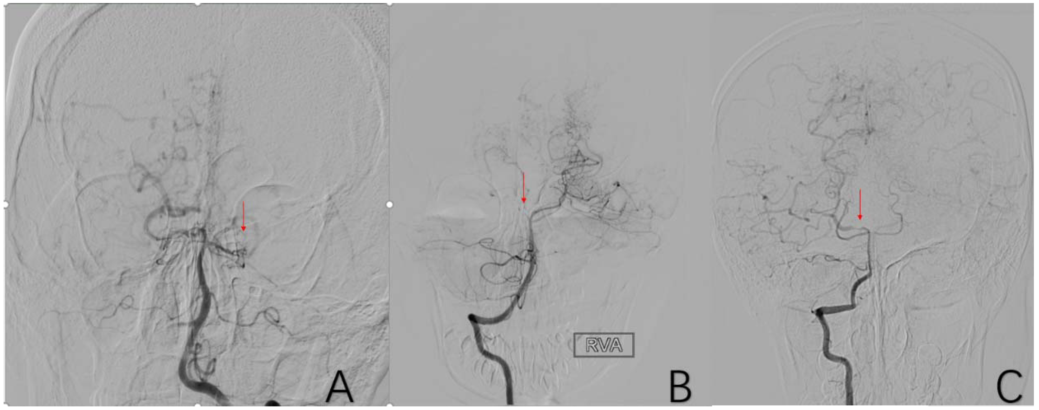 Brainsci 12 01270 g007