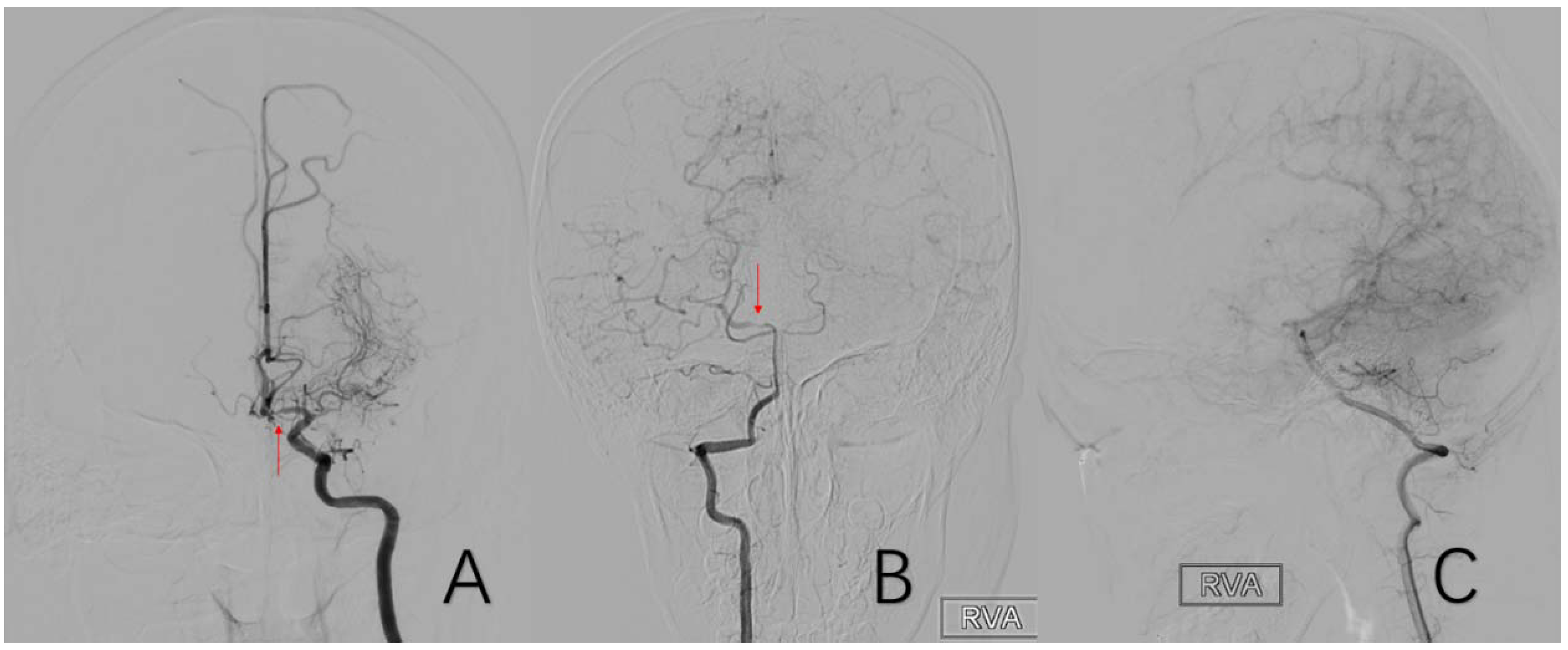 Brainsci 12 01270 g009