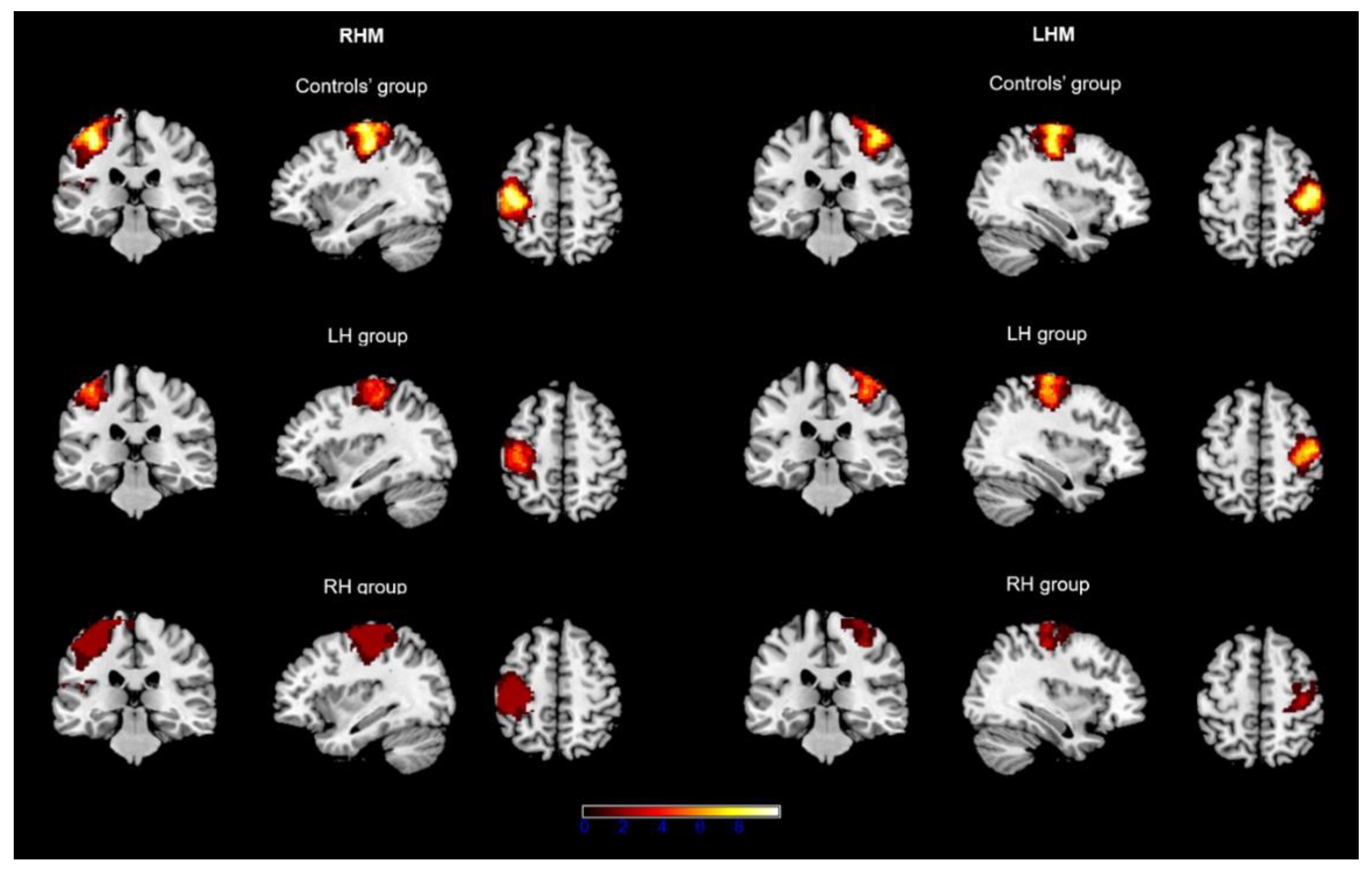 Fig. 1.  Long-Term Consequences of Switching Handedness: A