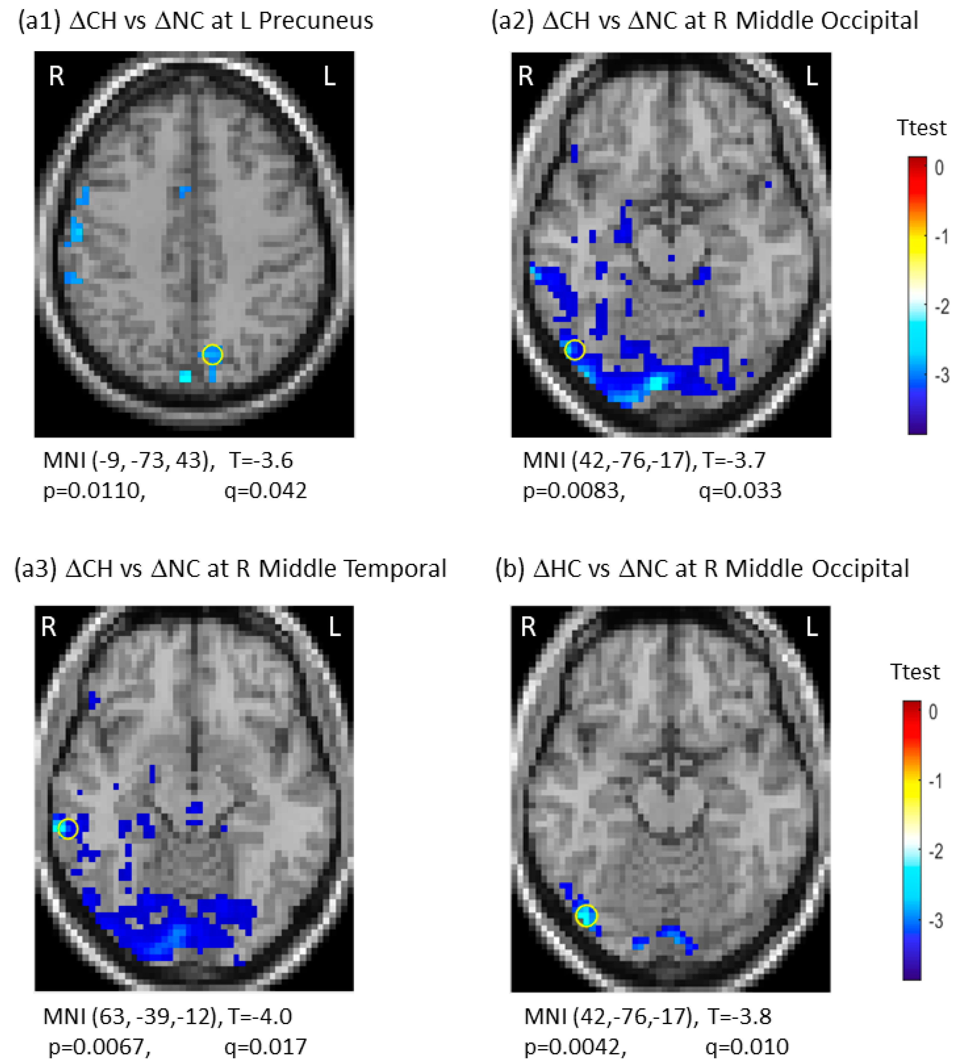 Brain Sciences Free FullText Signal Variability and Cognitive
