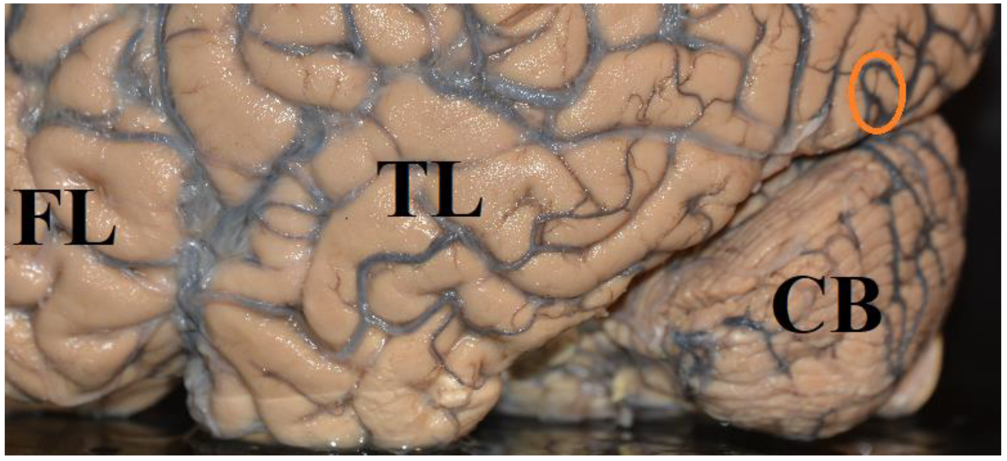 Brainsci 12 01305 g002 Brainsci 12 01305 g002