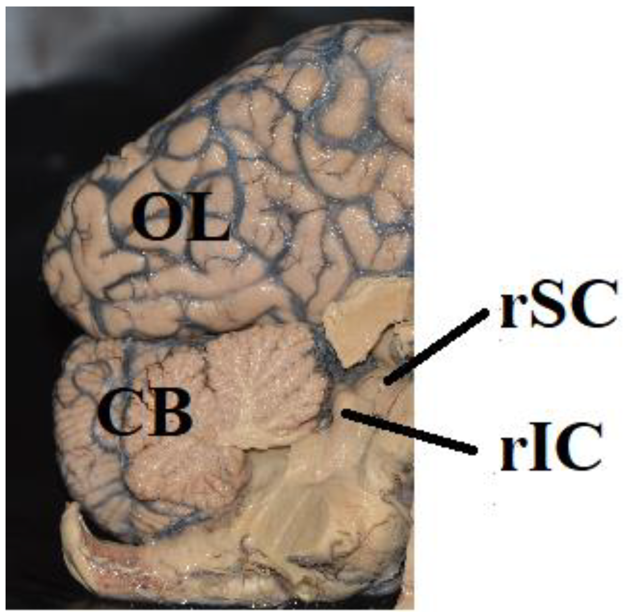 Brainsci 12 01305 g003 Brainsci 12 01305 g003