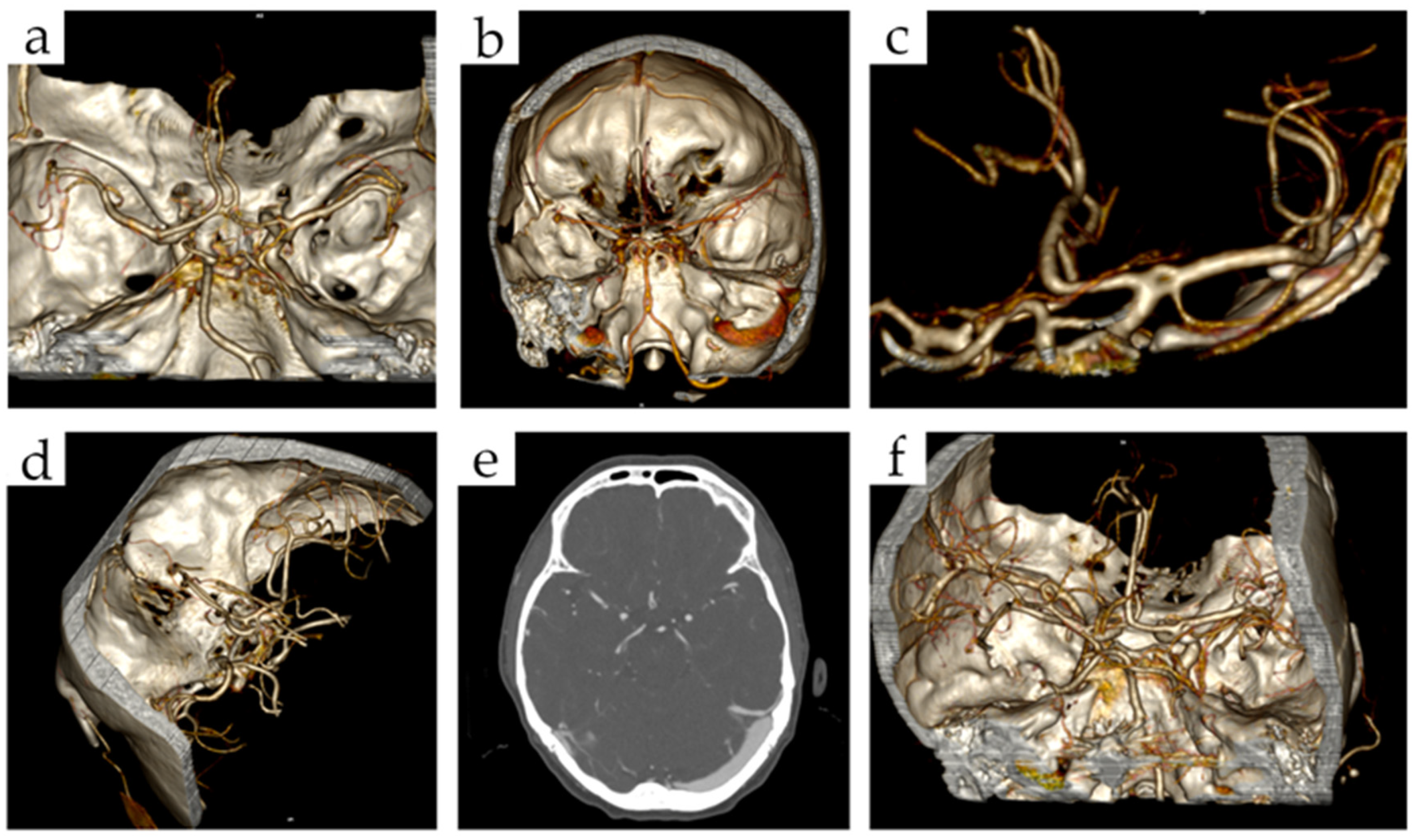 Brainsci 12 01310 g001 Brainsci 12 01310 g001